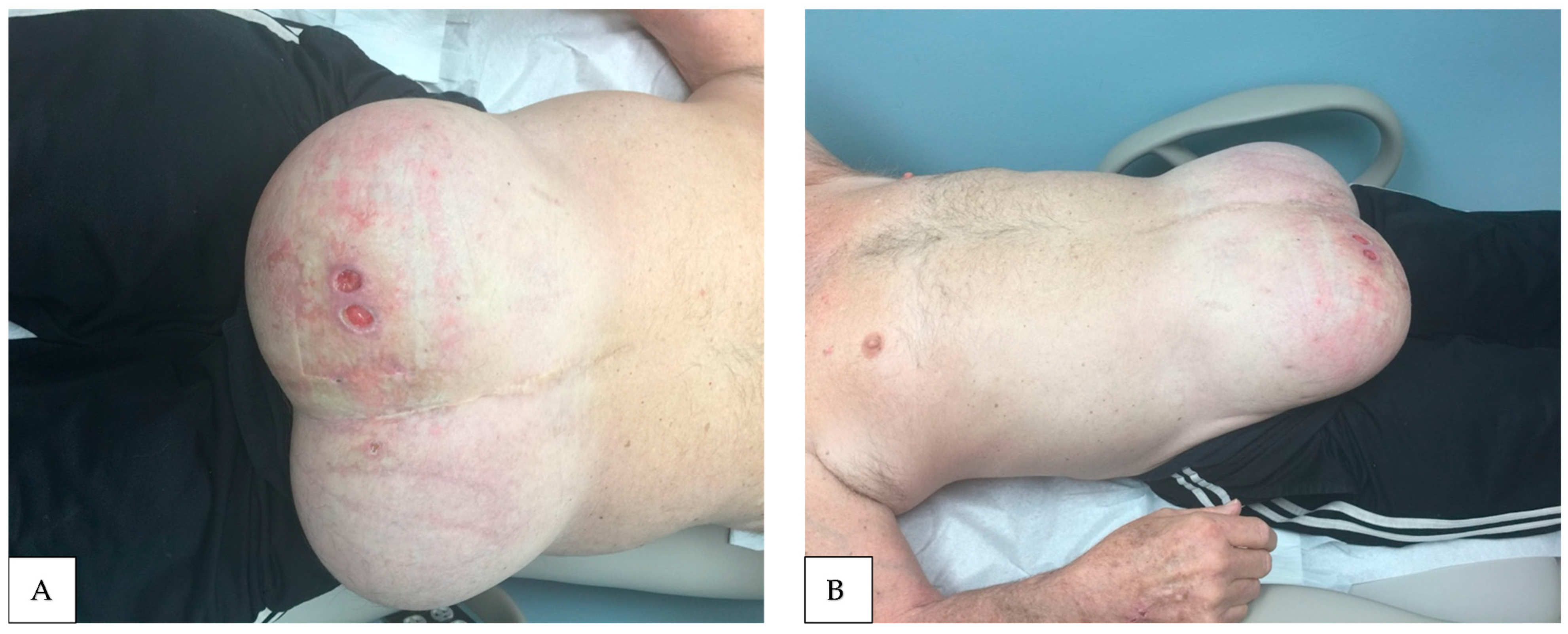 Livers 05 00037 g006