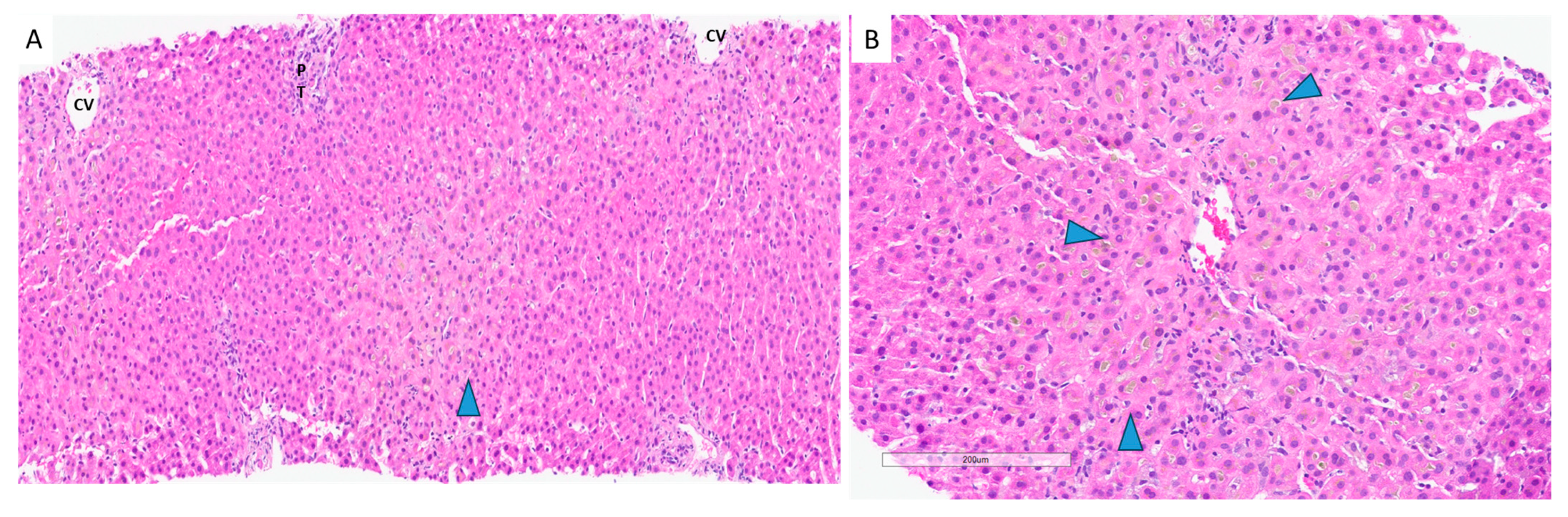 Livers 05 00042 g002 Livers 05 00042 g002