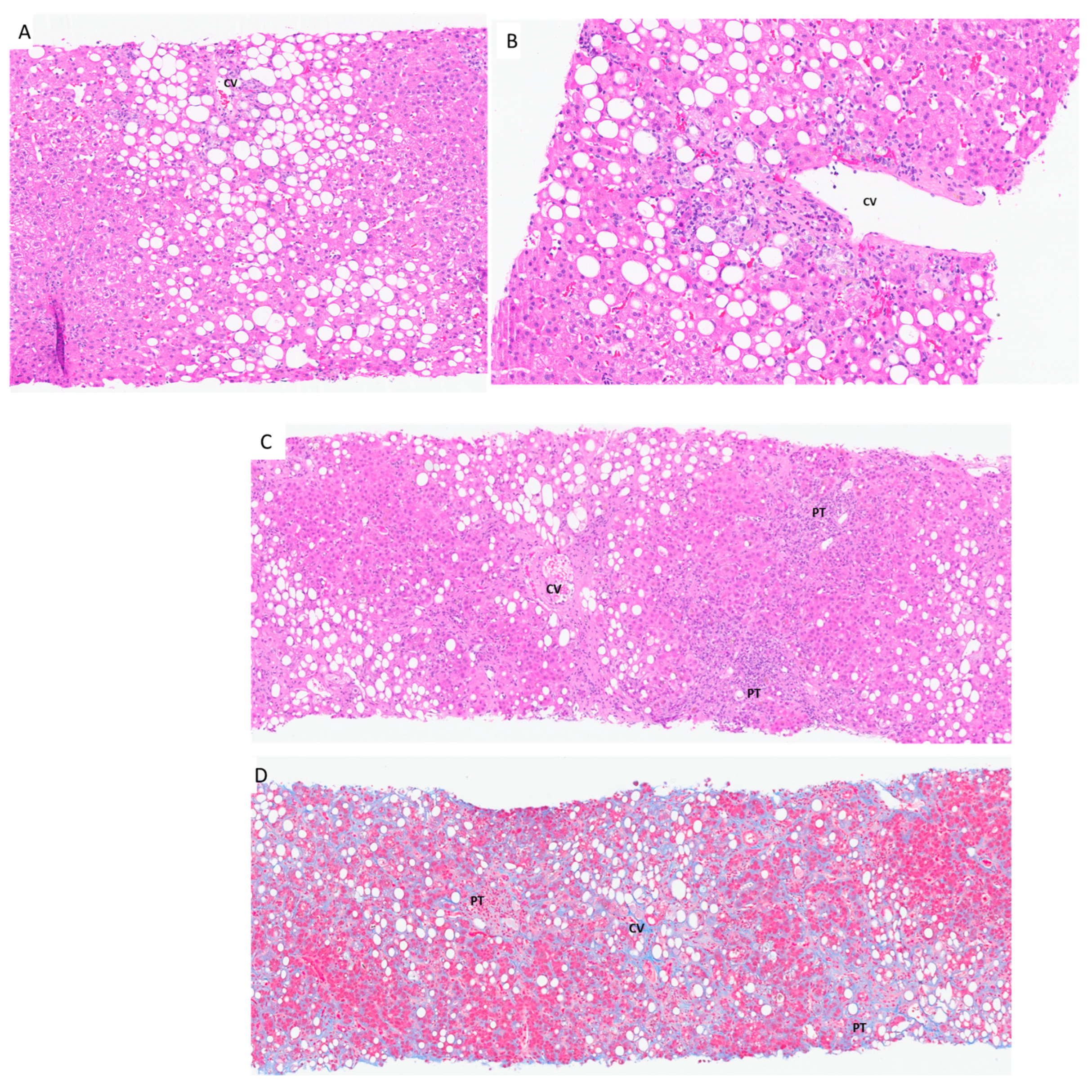 Livers 05 00042 g005 Livers 05 00042 g005