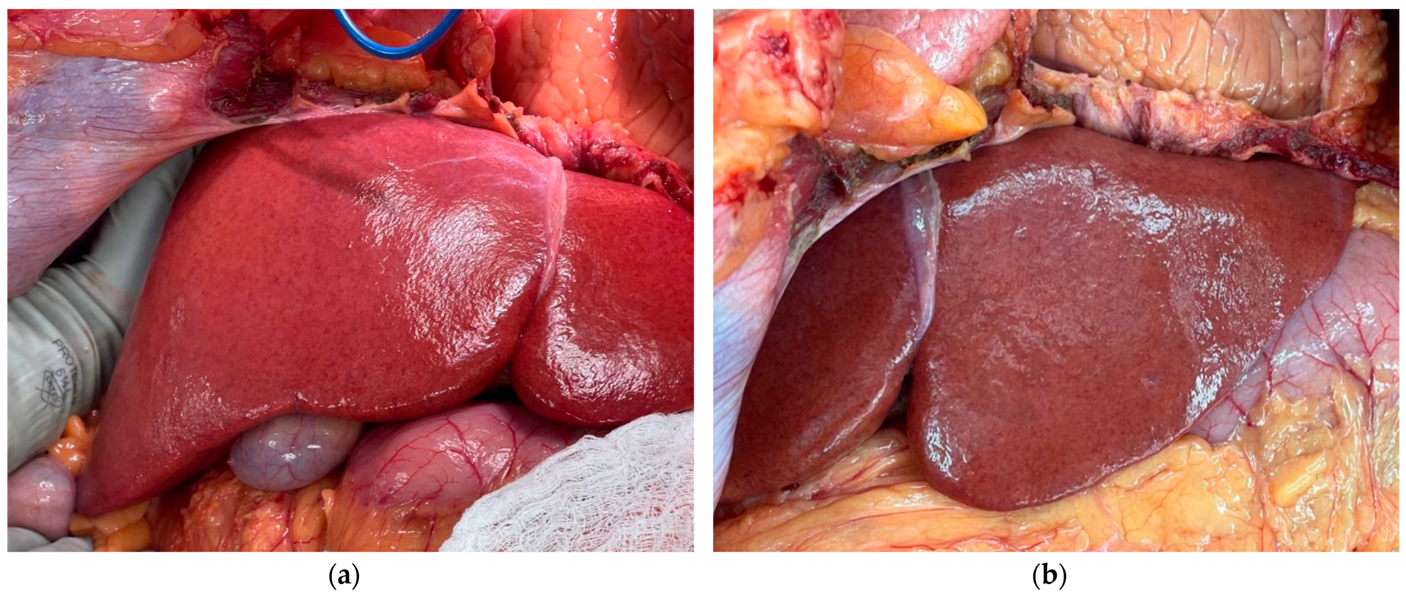 Livers 05 00066 g002