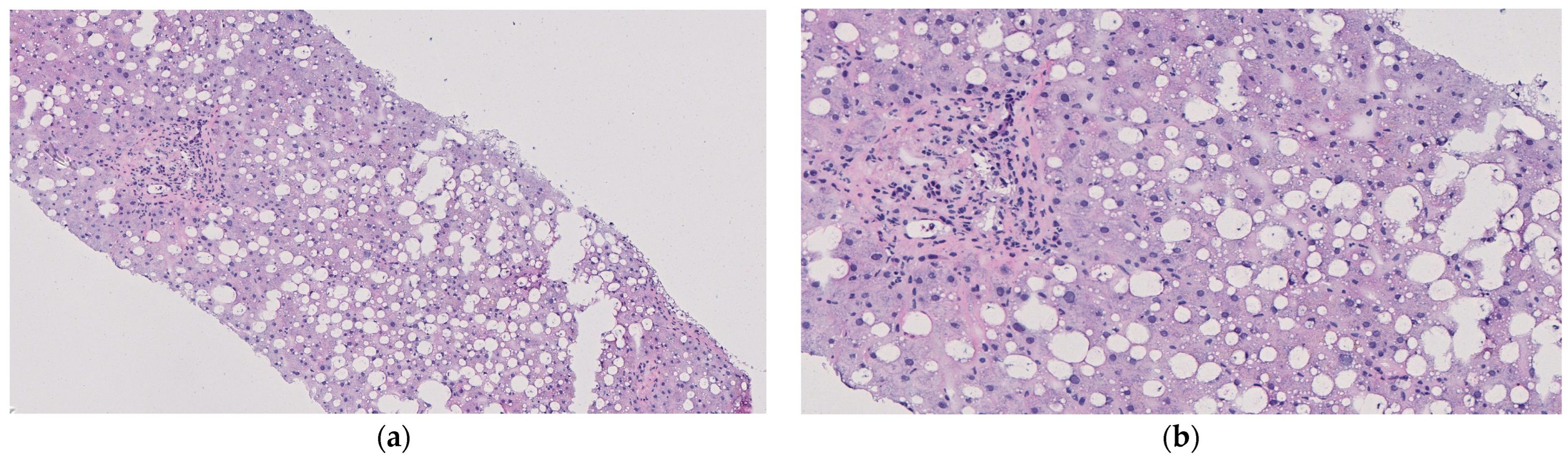 Livers 05 00066 g003a