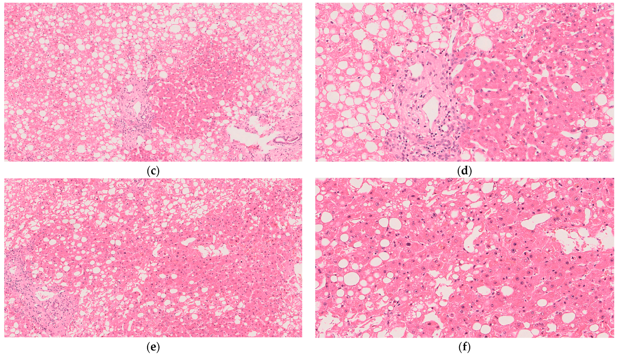 Livers 05 00066 g003b