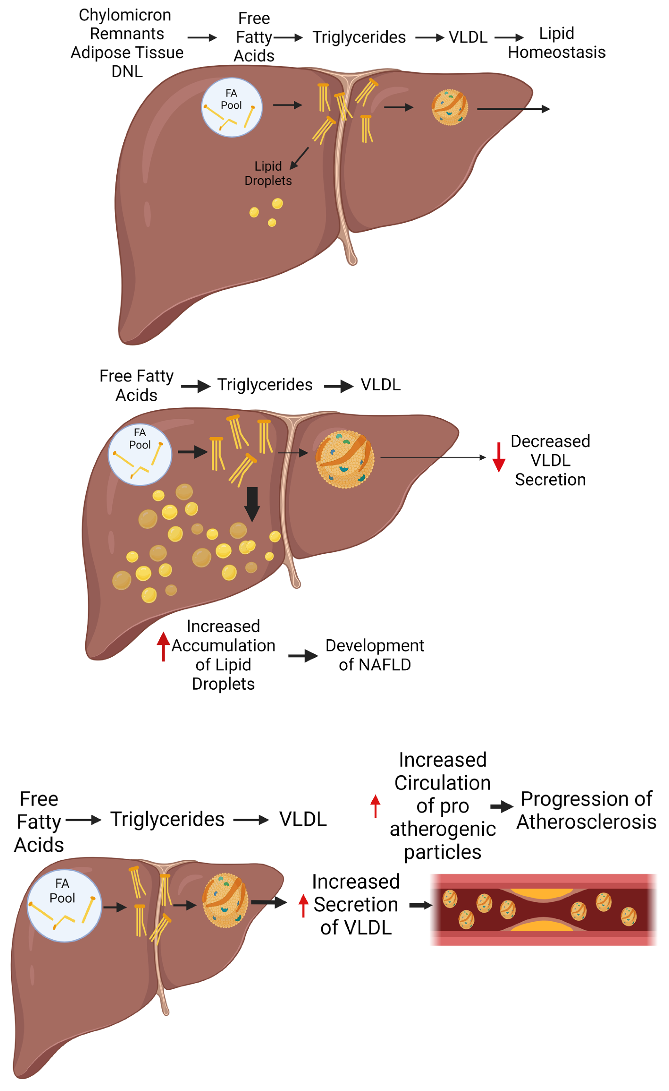 The Liver at the Crossroads: Orchestrating Lipoprotein Dynamics