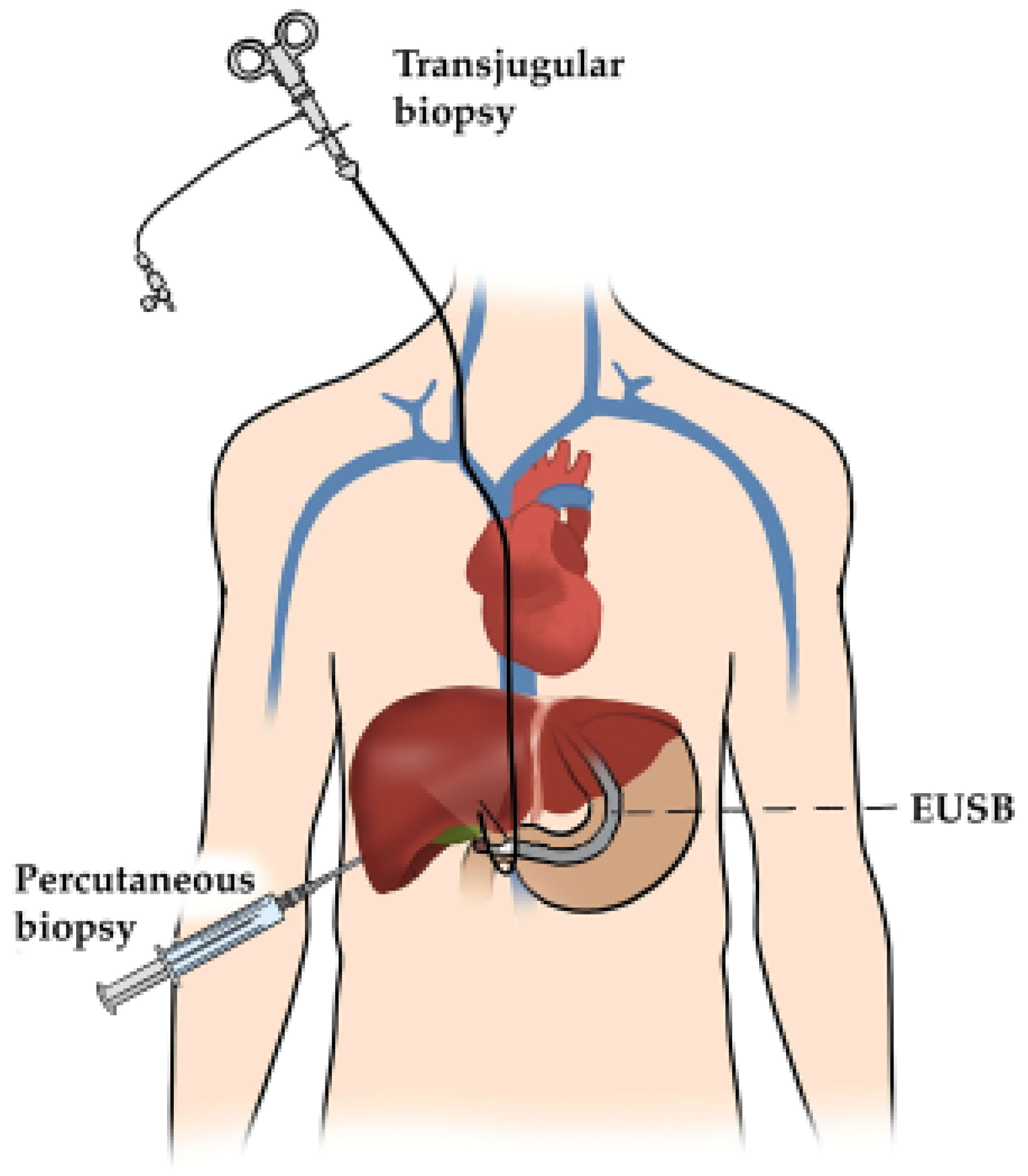 Livers 06 00023 g001