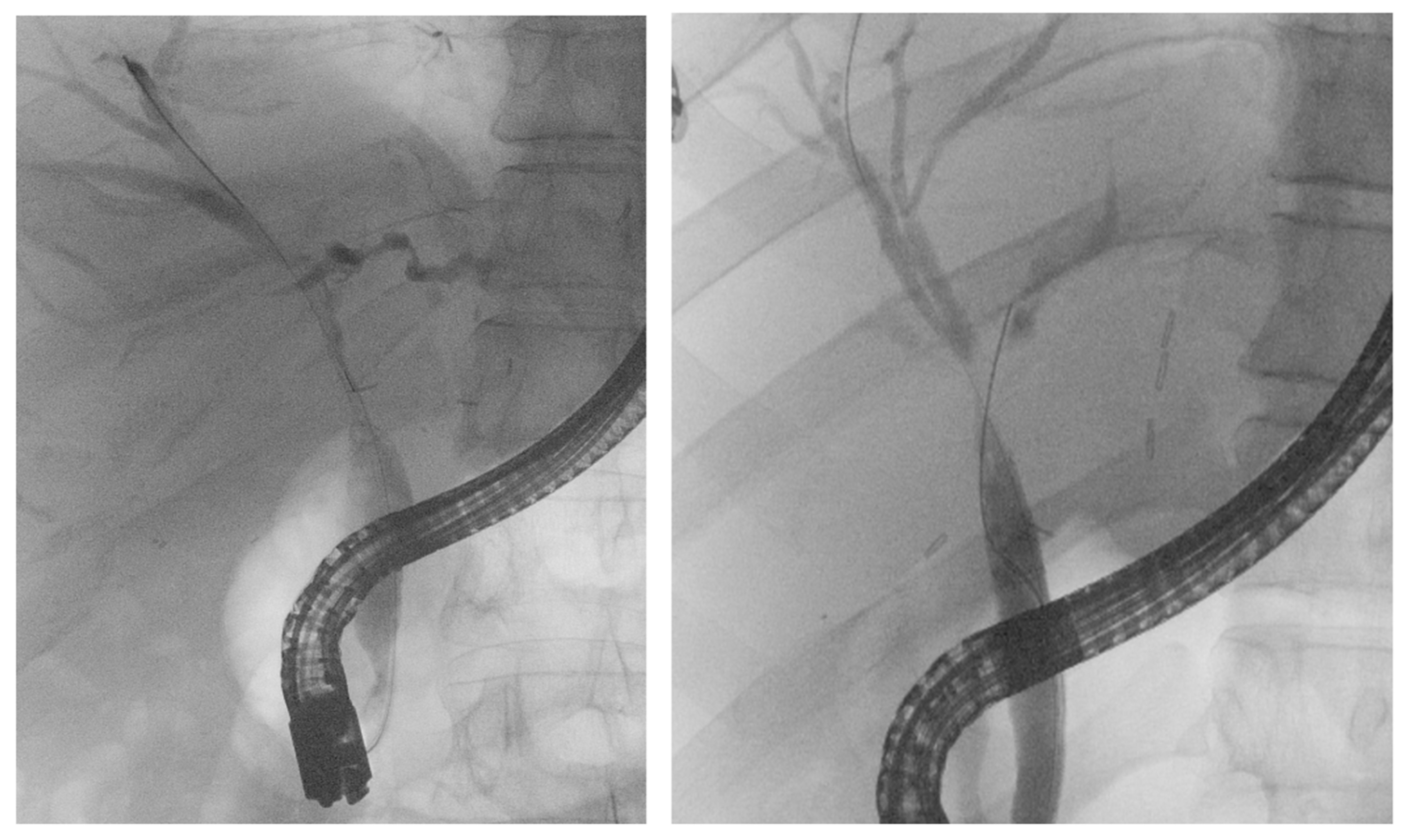 Livers 06 00097 g005 Livers 06 00097 g005