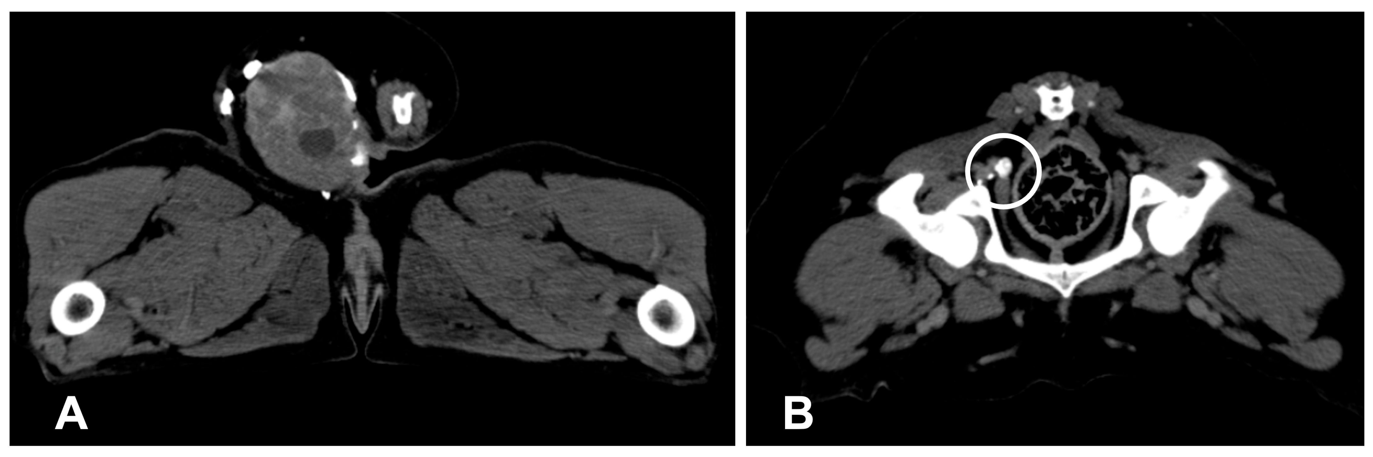 Lymphatics 01 00002 g002 Lymphatics 01 00002 g002