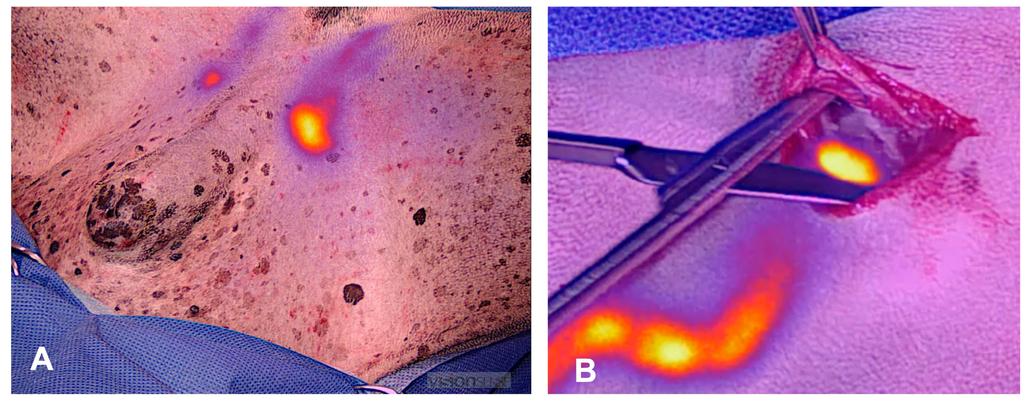 Lymphatics 01 00002 g003 Lymphatics 01 00002 g003