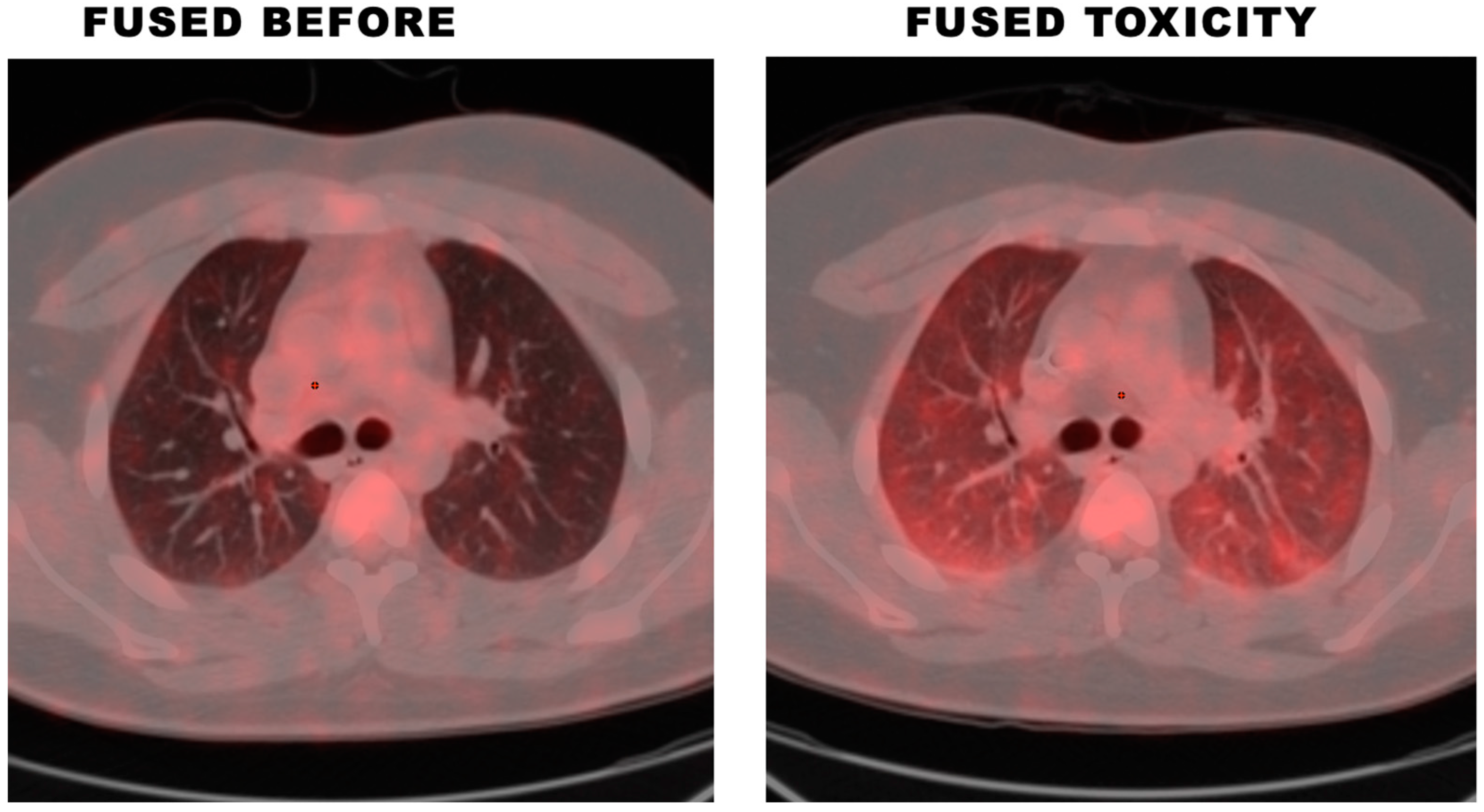 Lymphatics 01 00006 g001 Lymphatics 01 00006 g001