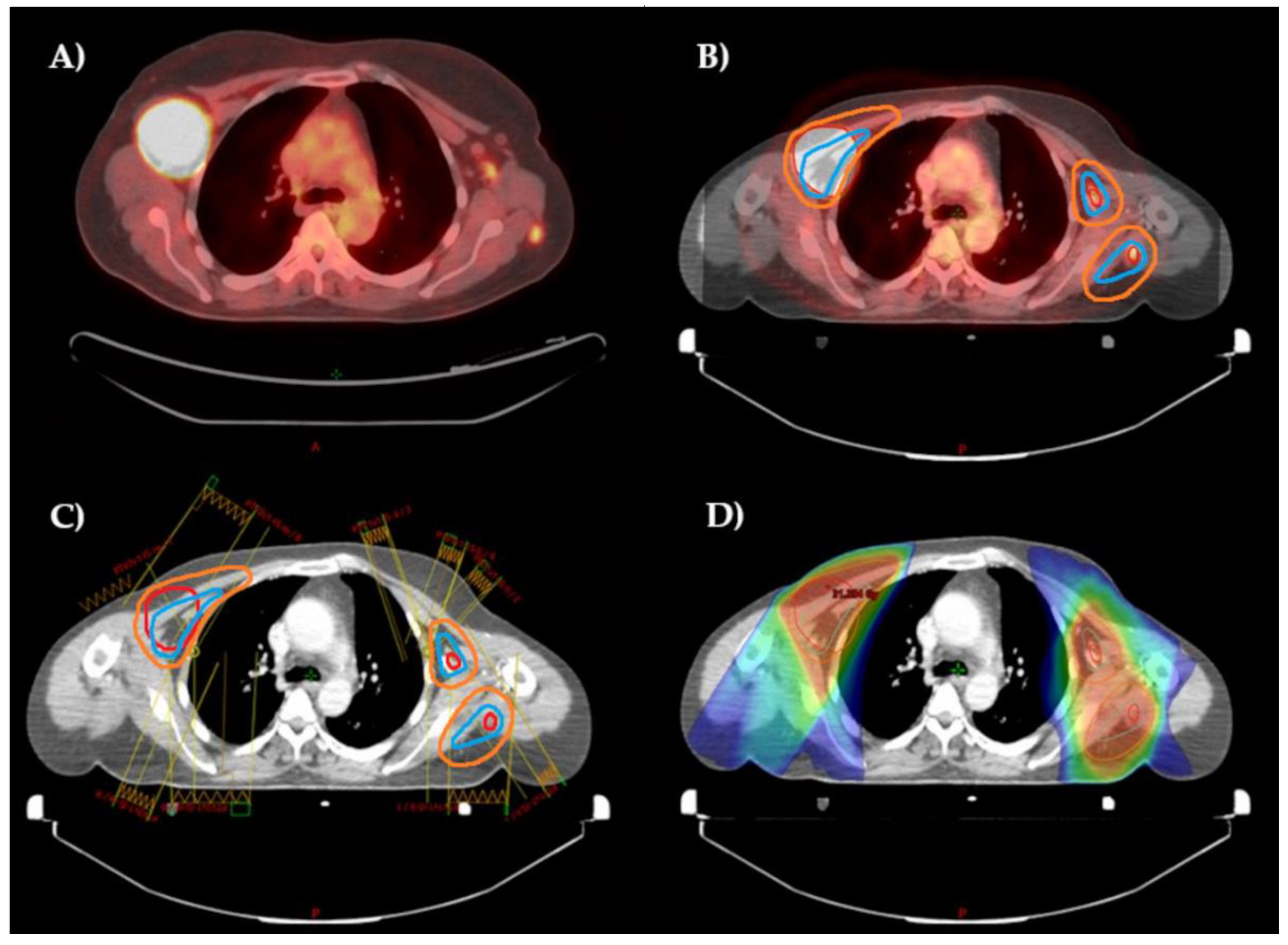 Lymphatics 01 00017 g002