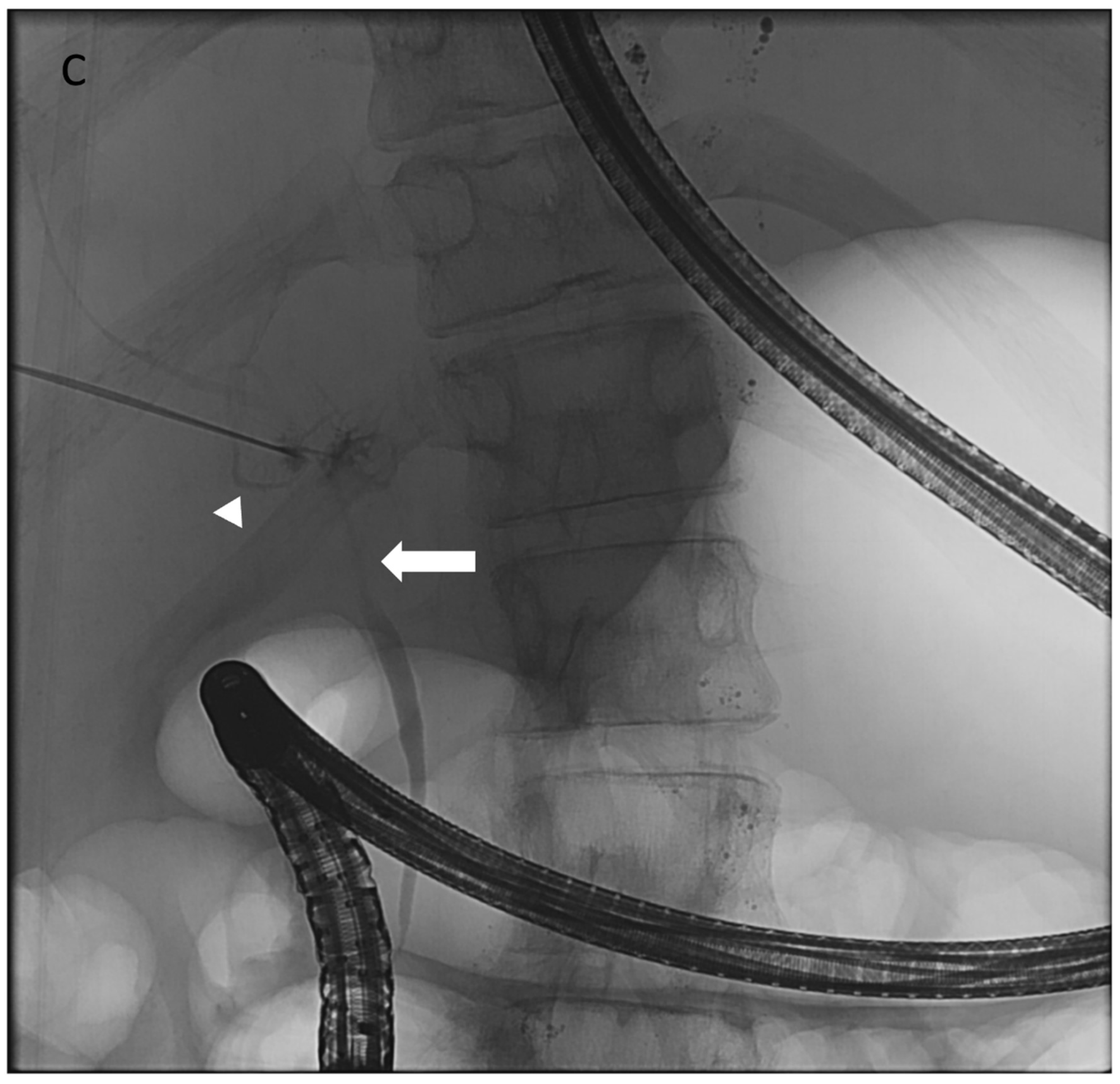 Lymphatics 03 00008 g002b