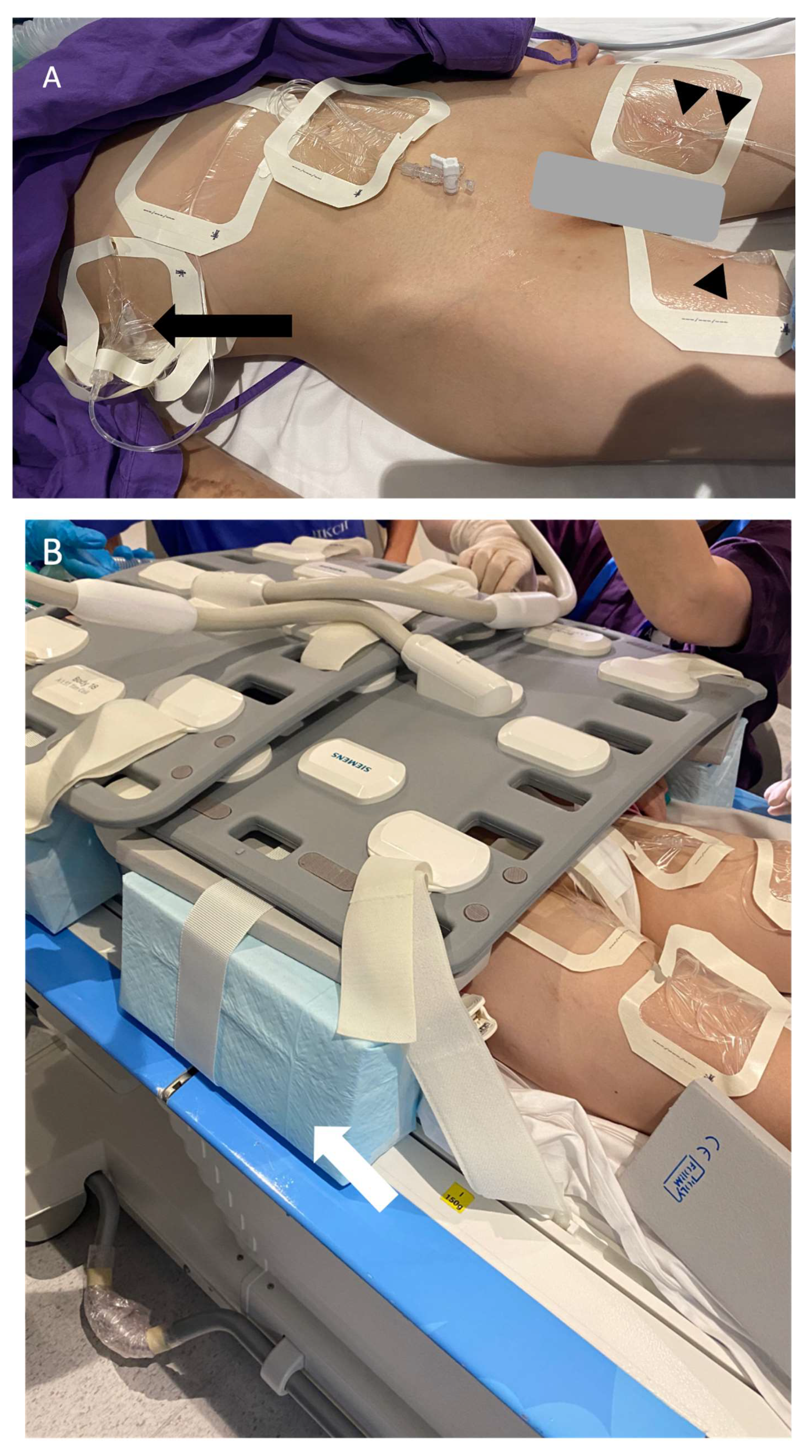 Lymphatics 03 00008 g003