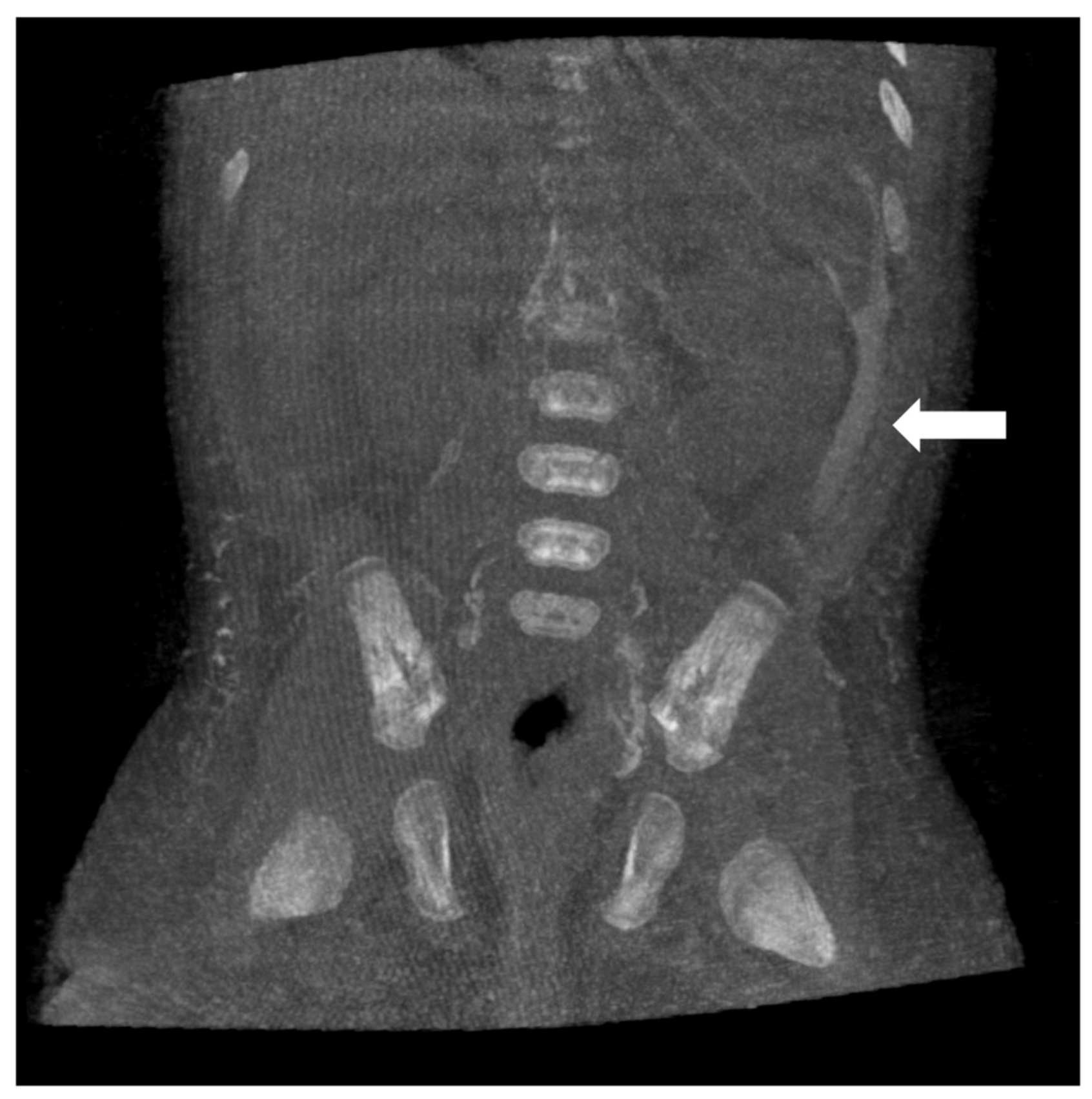 Lymphatics 03 00008 g004