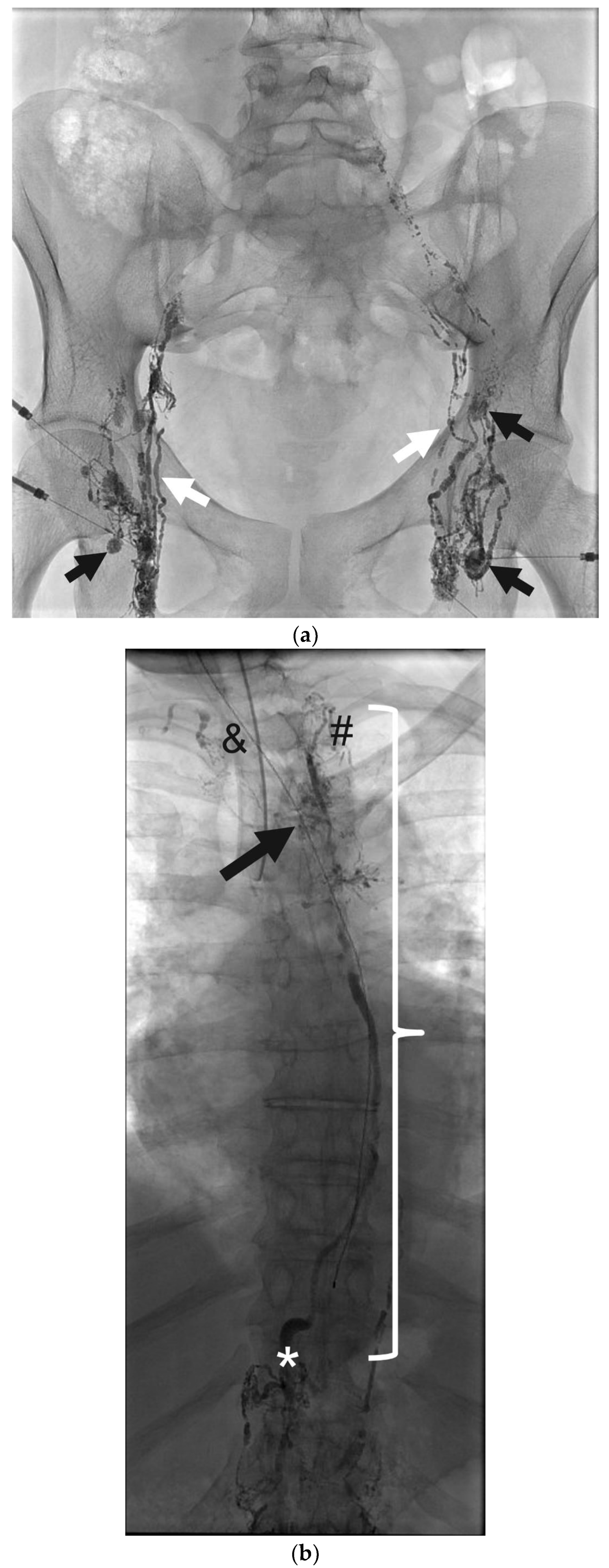 Lymphatics 03 00008 g006