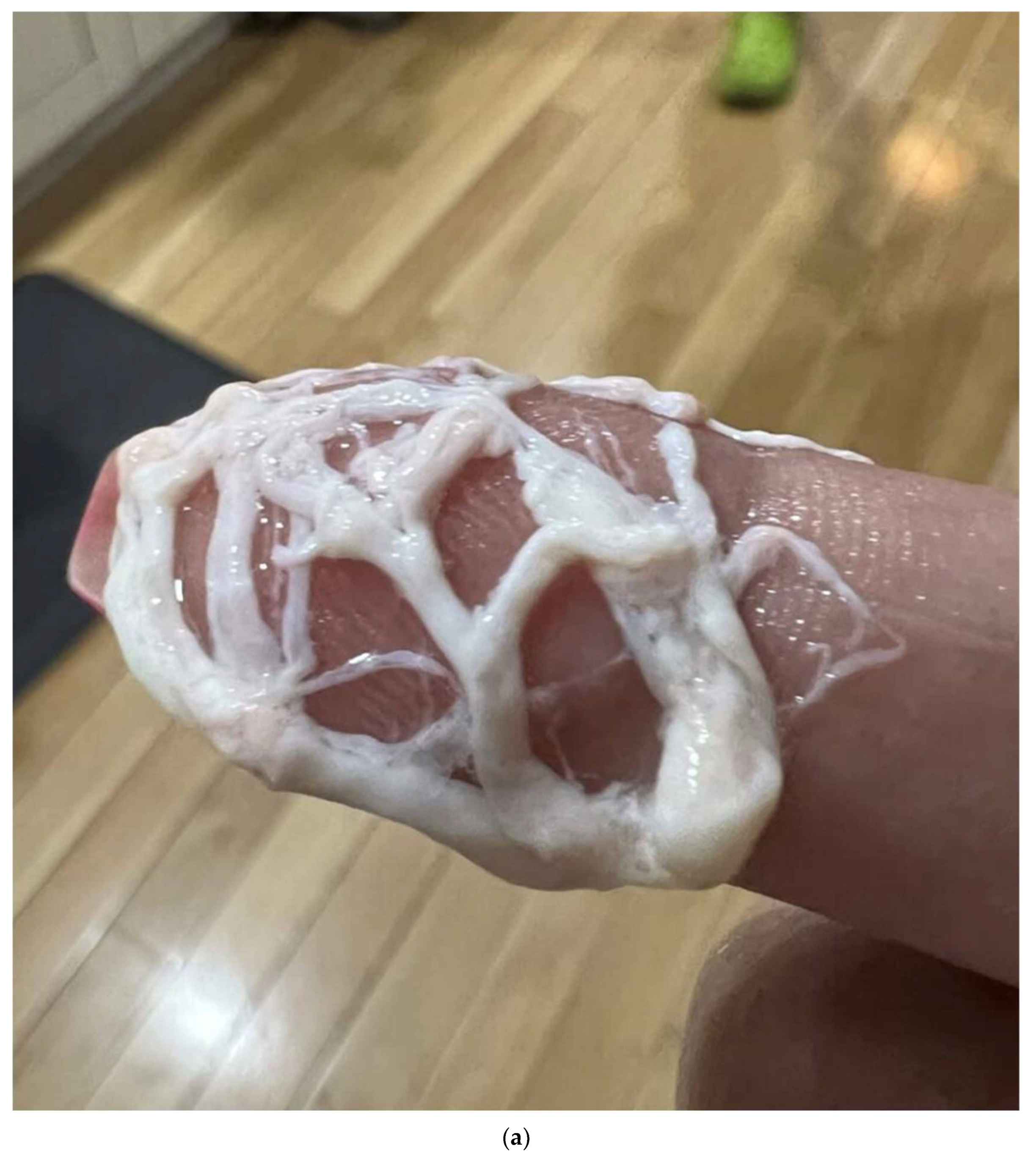 Lymphatics 03 00008 g009a