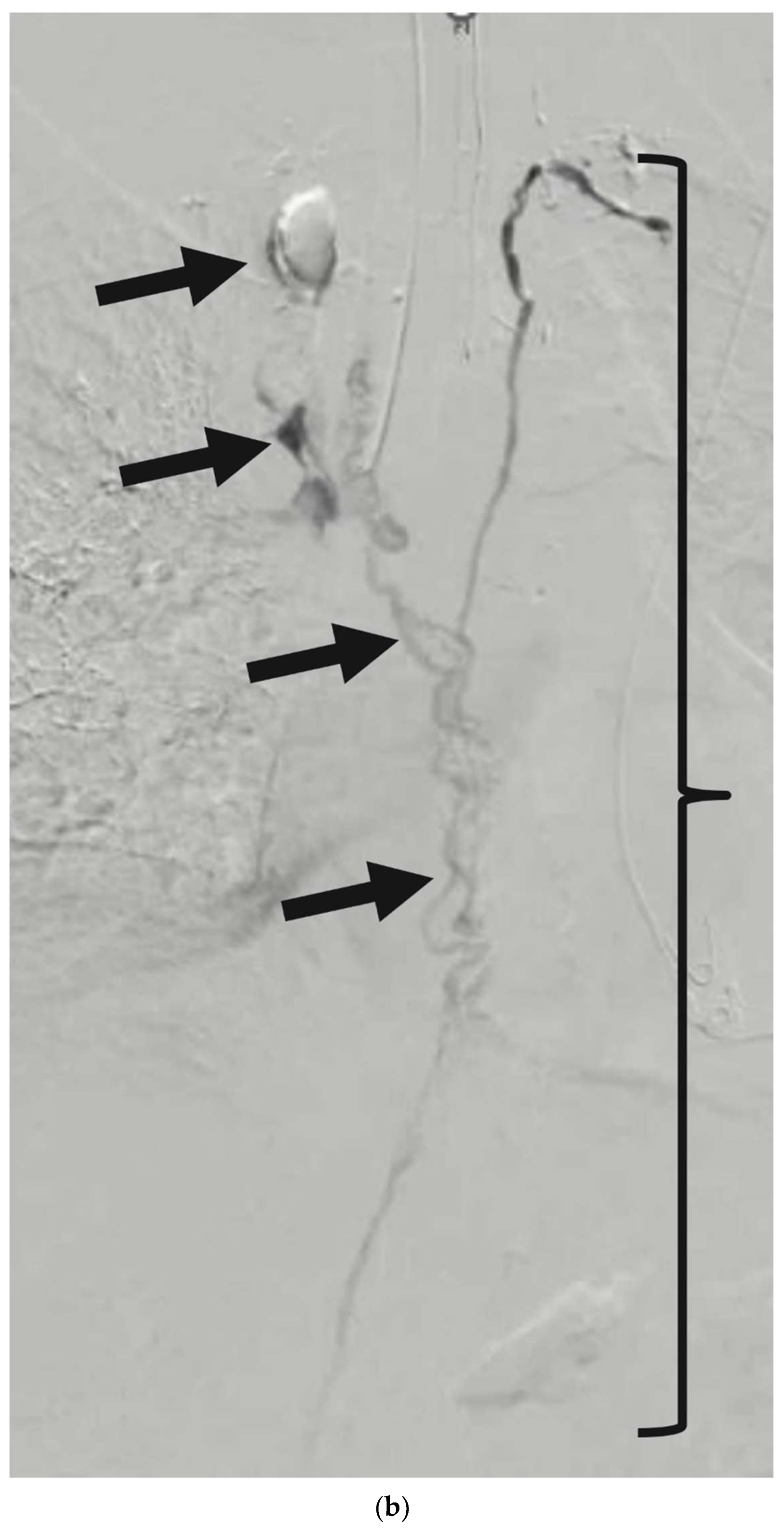 Lymphatics 03 00008 g009b