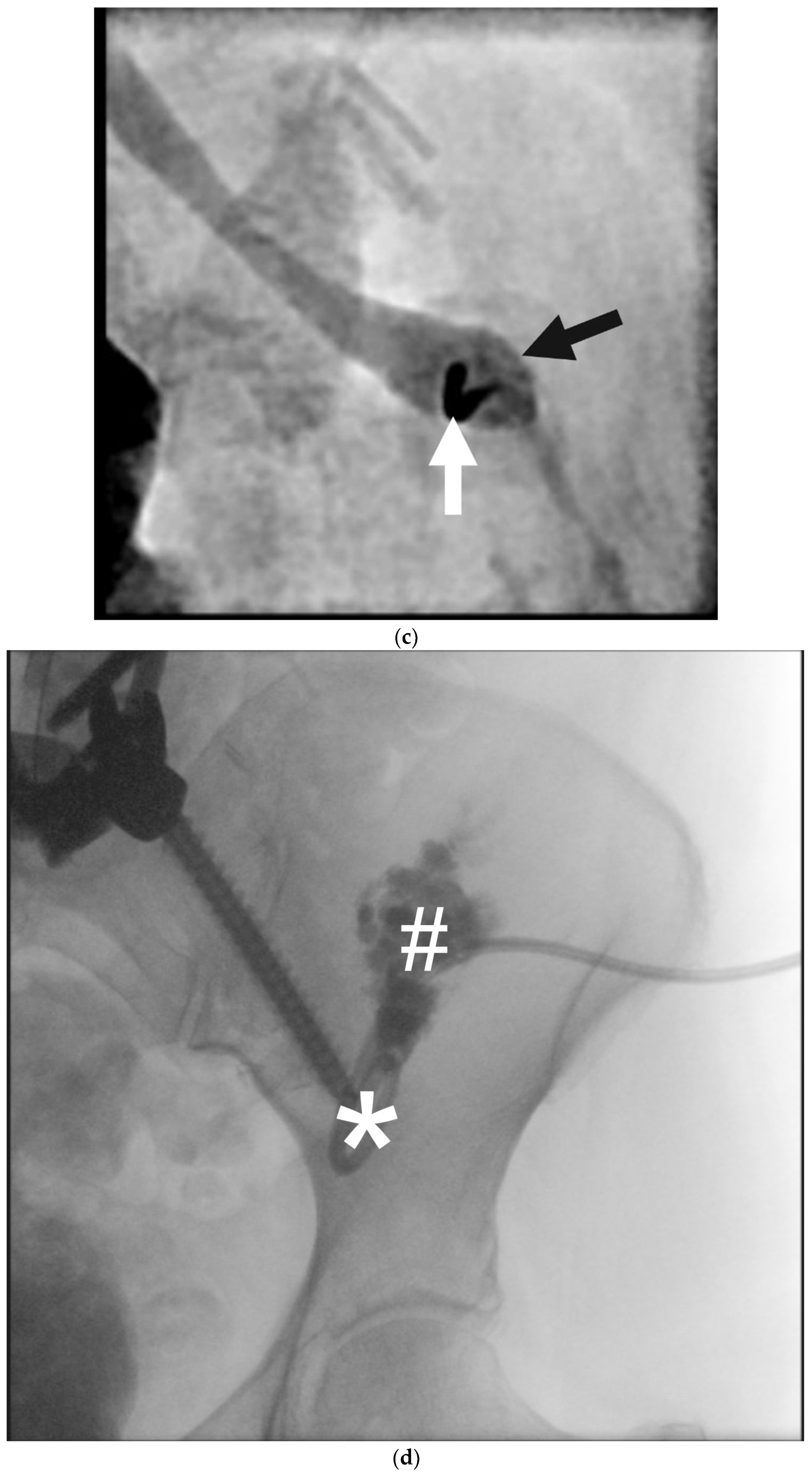 Lymphatics 03 00008 g010b