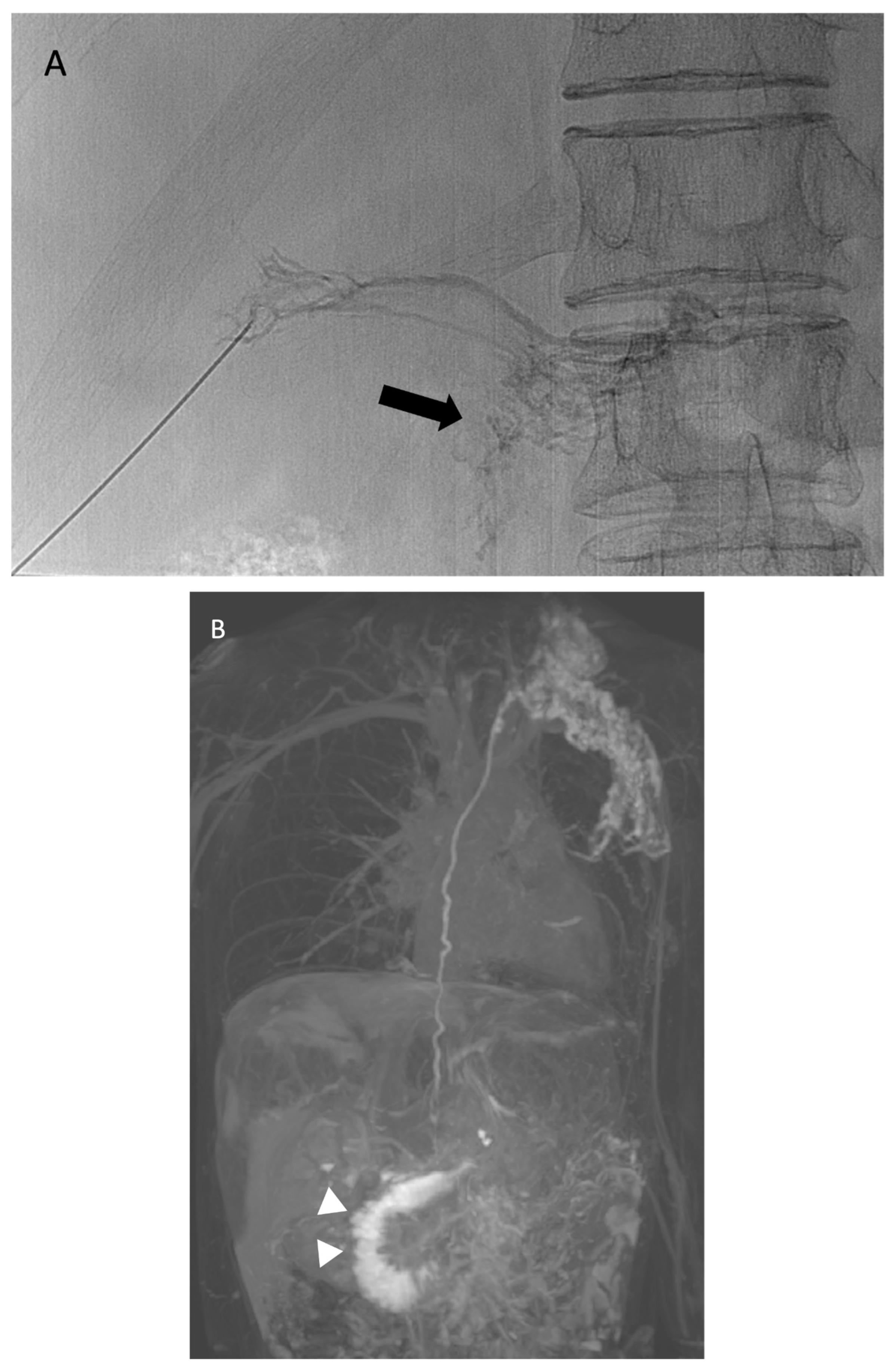 Lymphatics 03 00008 g011a