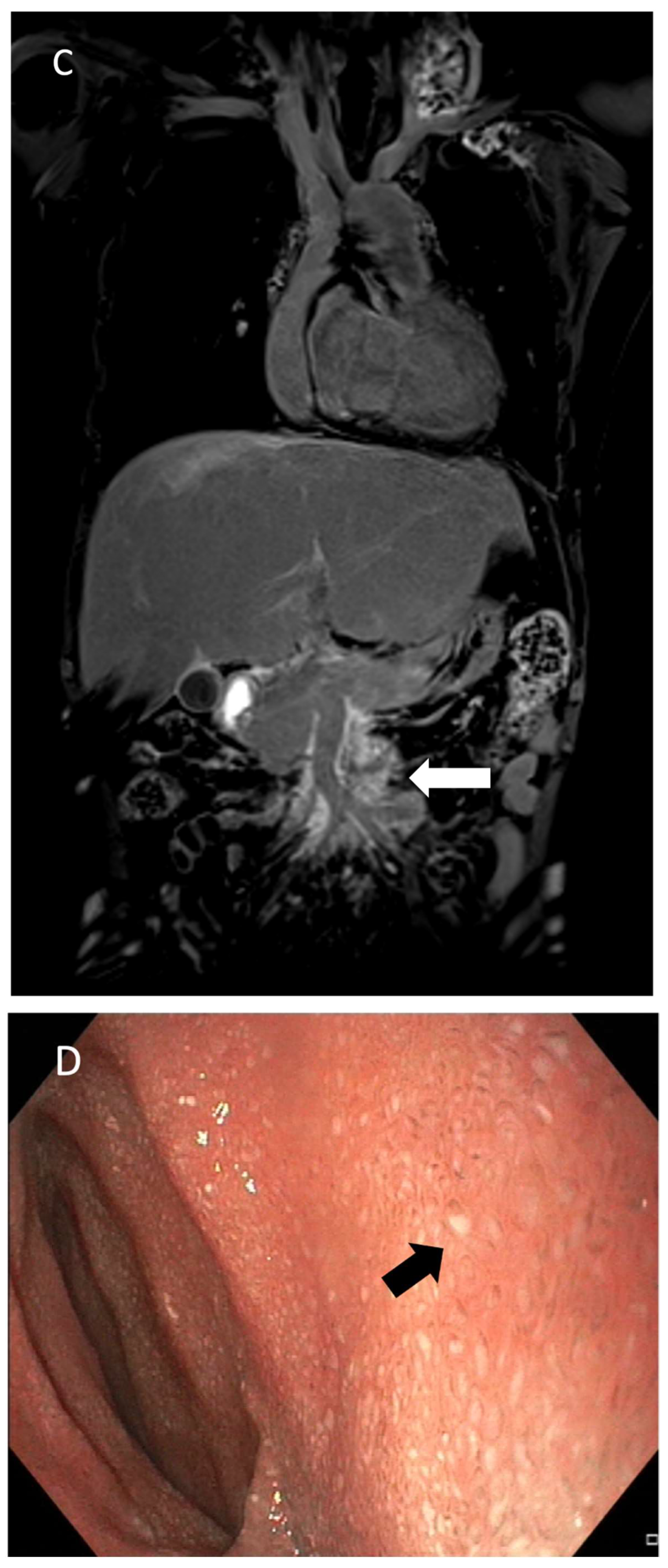 Lymphatics 03 00008 g011b