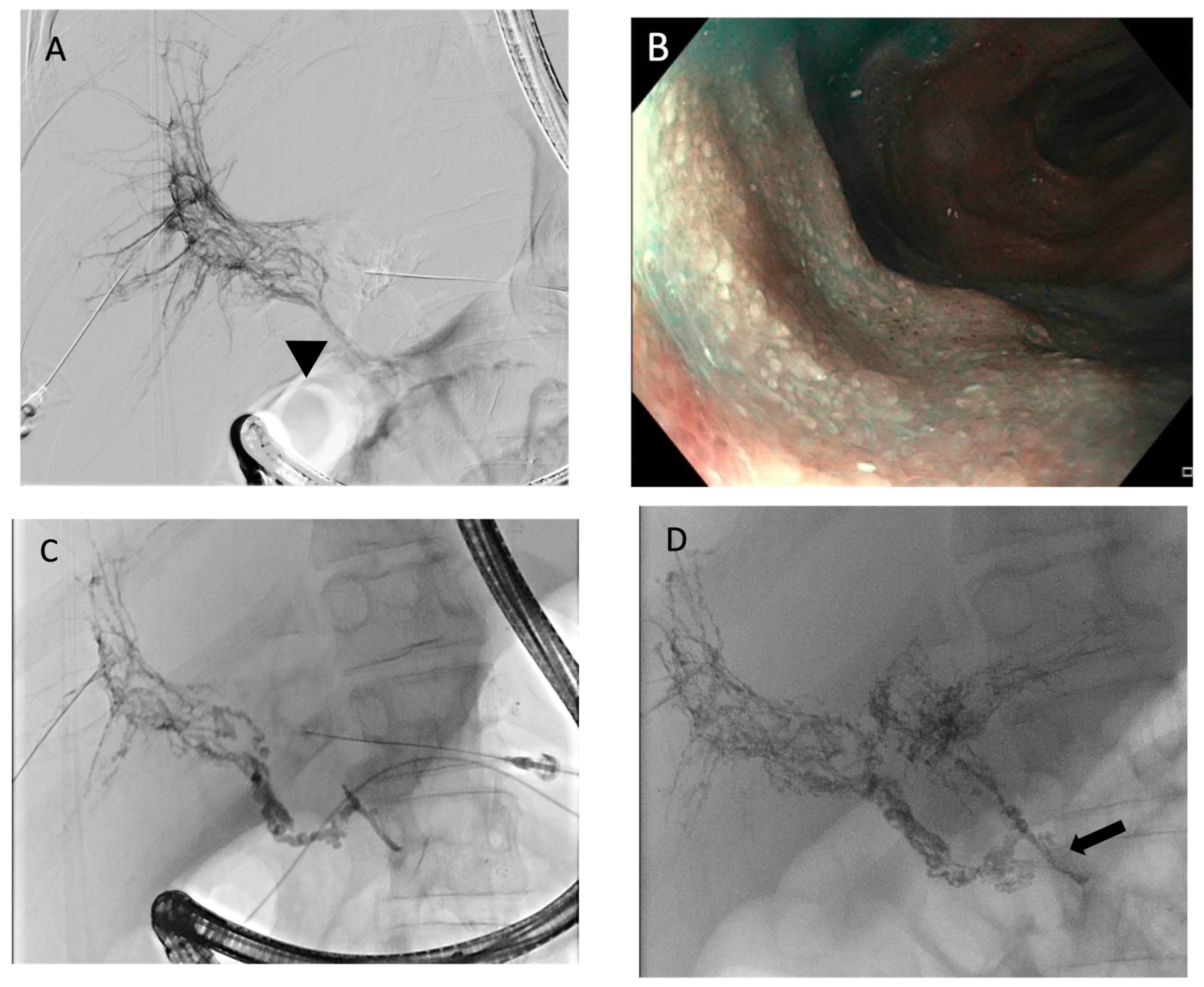 Lymphatics 03 00008 g012