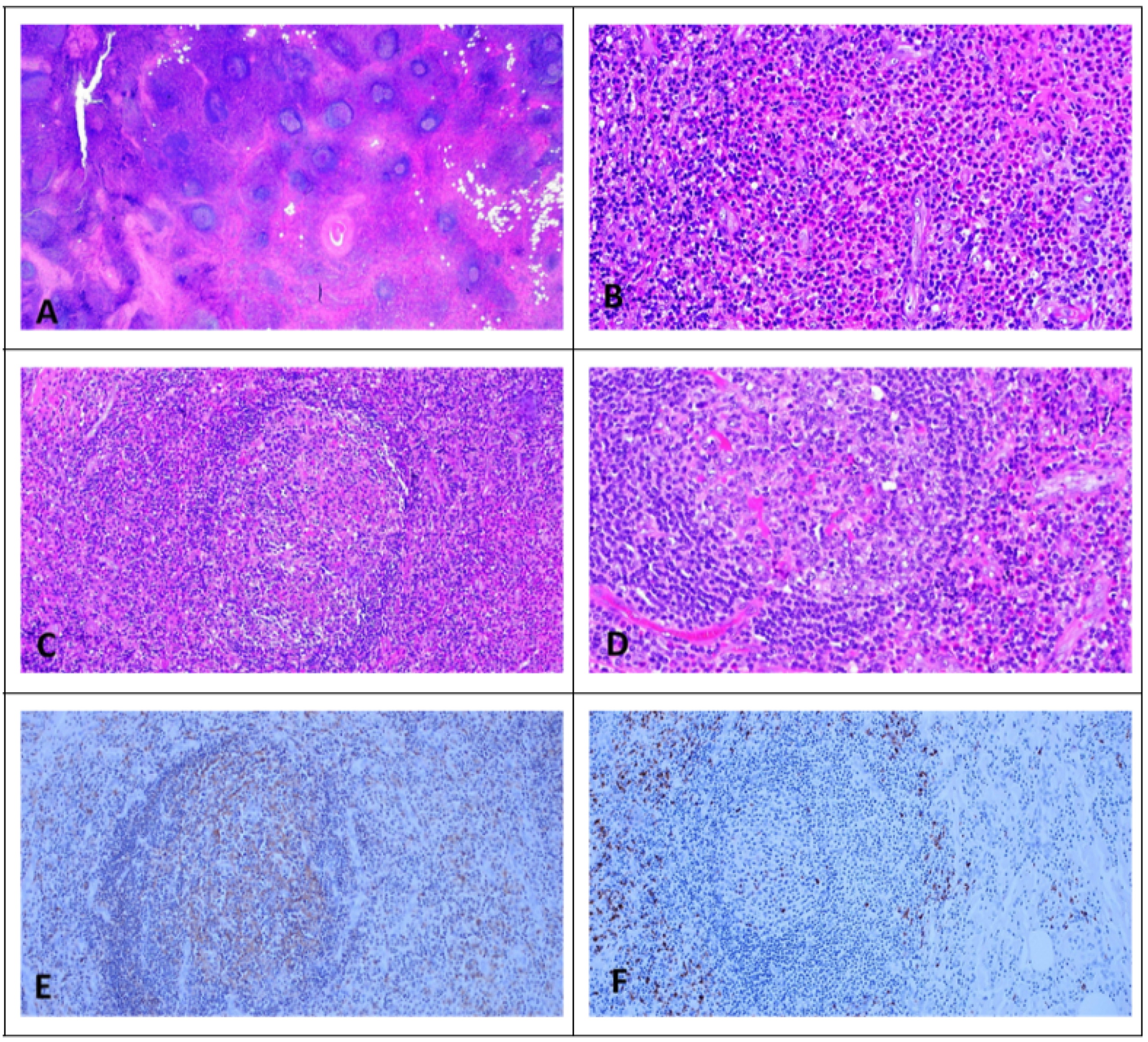 Lymphatics 03 00010 g001