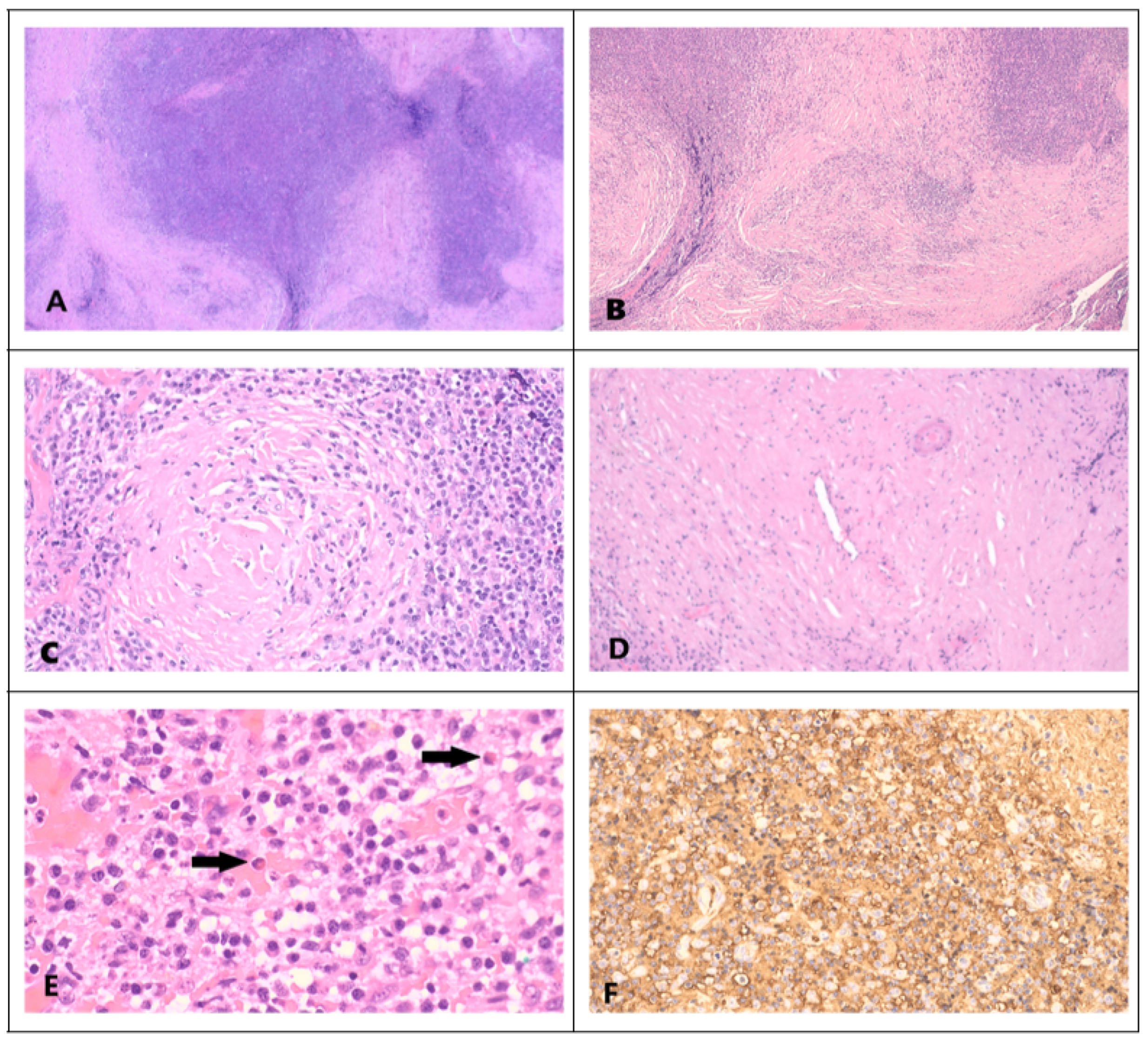 Lymphatics 03 00010 g002