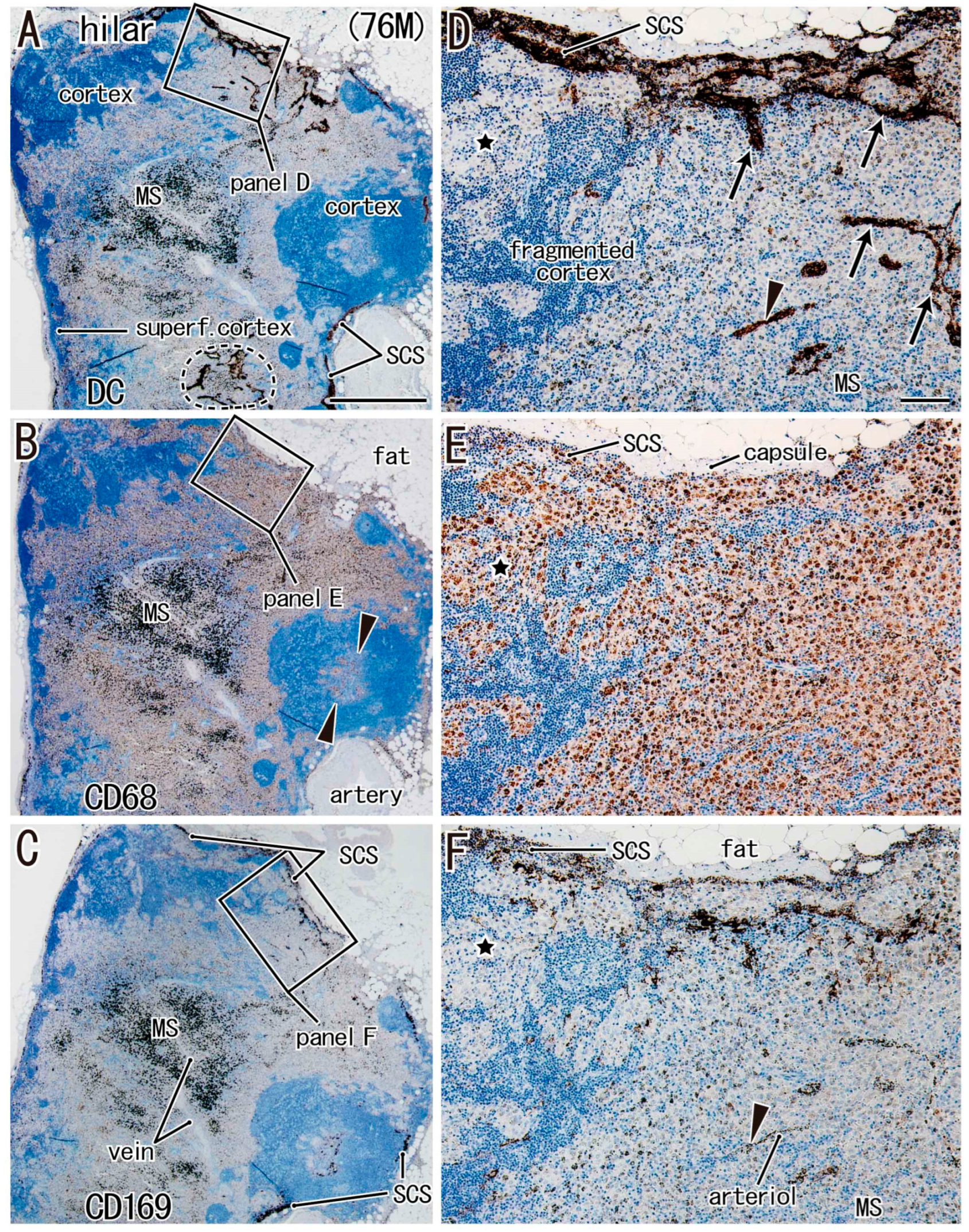 Lymphatics 03 00013 g001