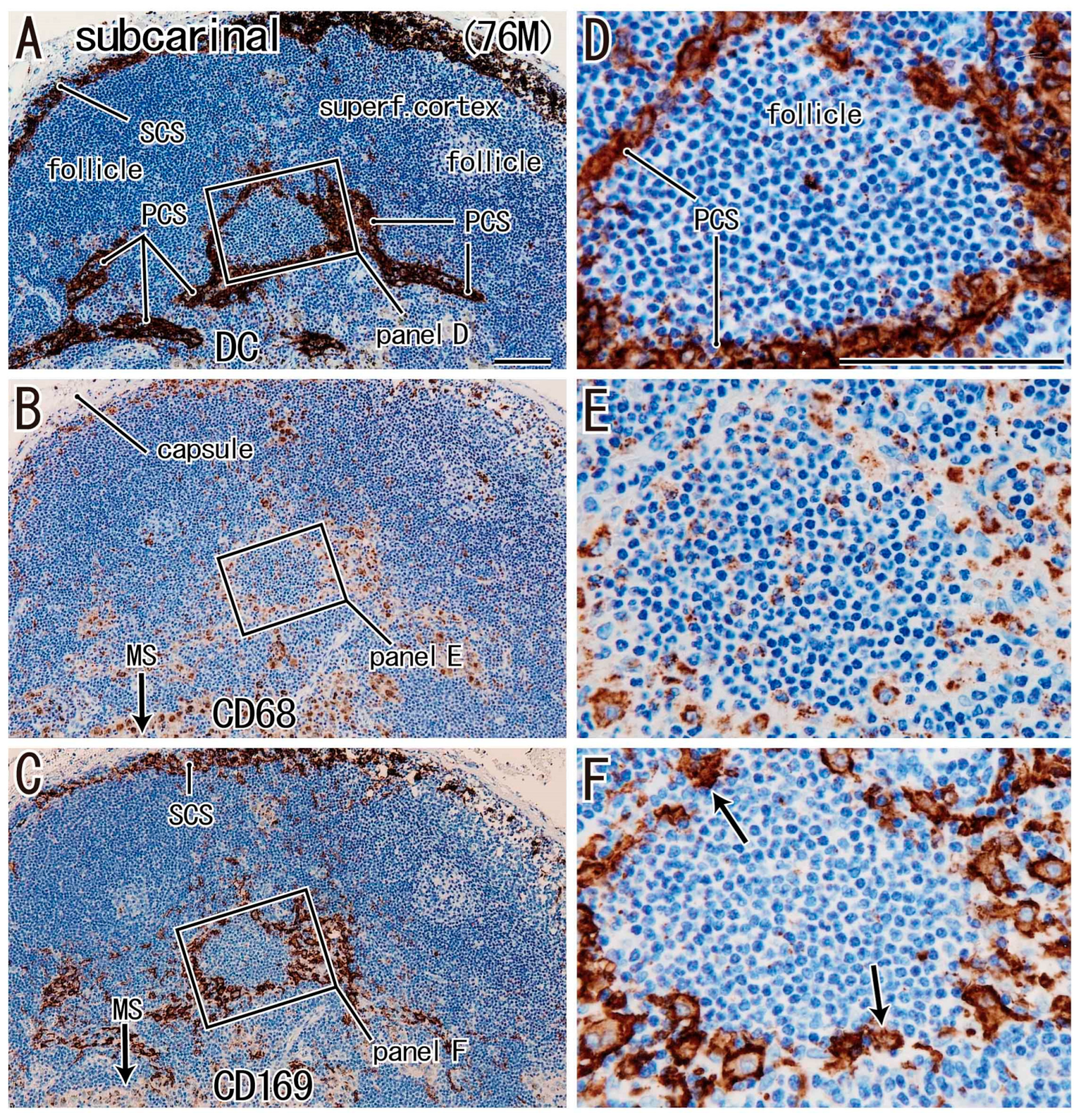 Lymphatics 03 00013 g003