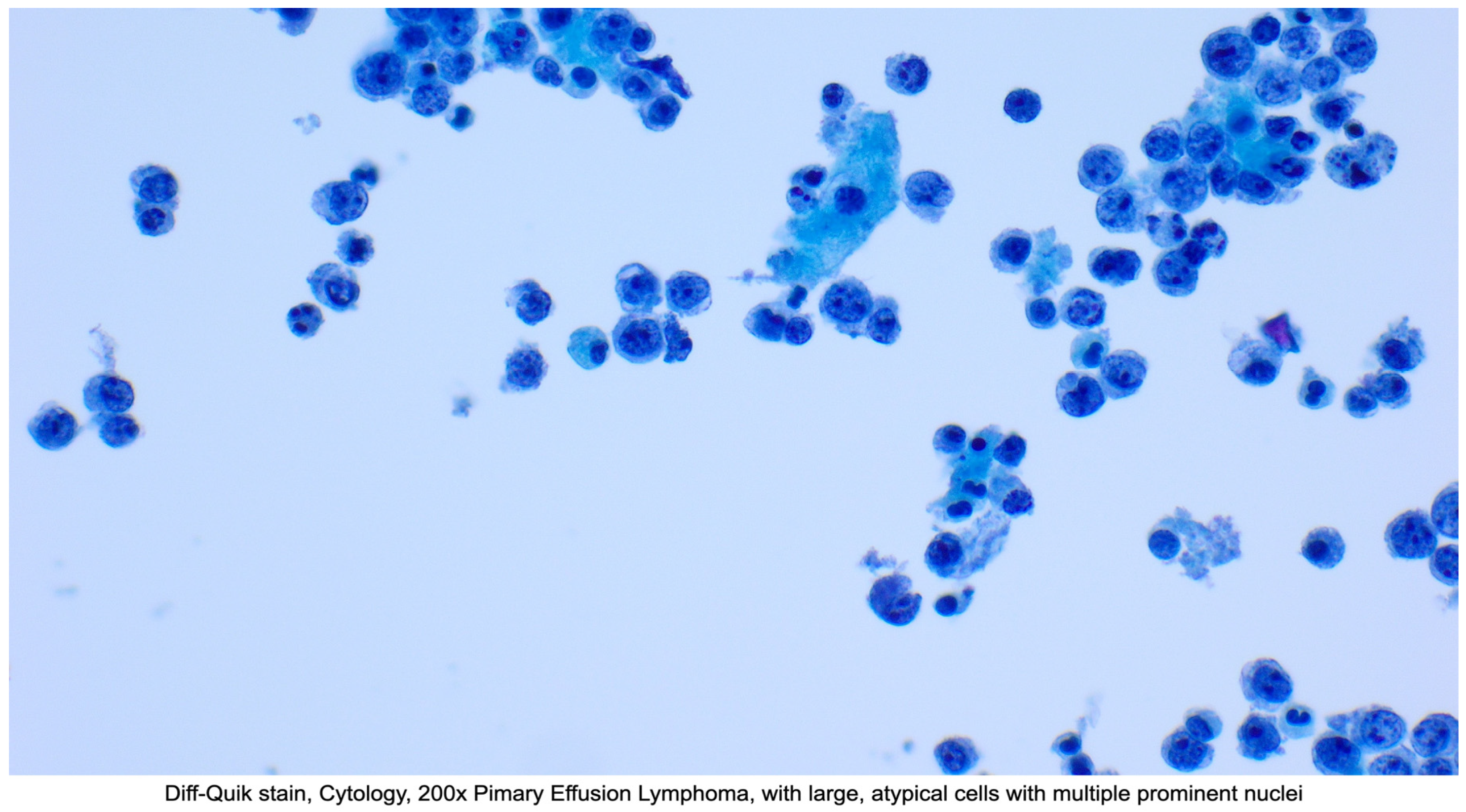 Lymphatics 03 00020 g001