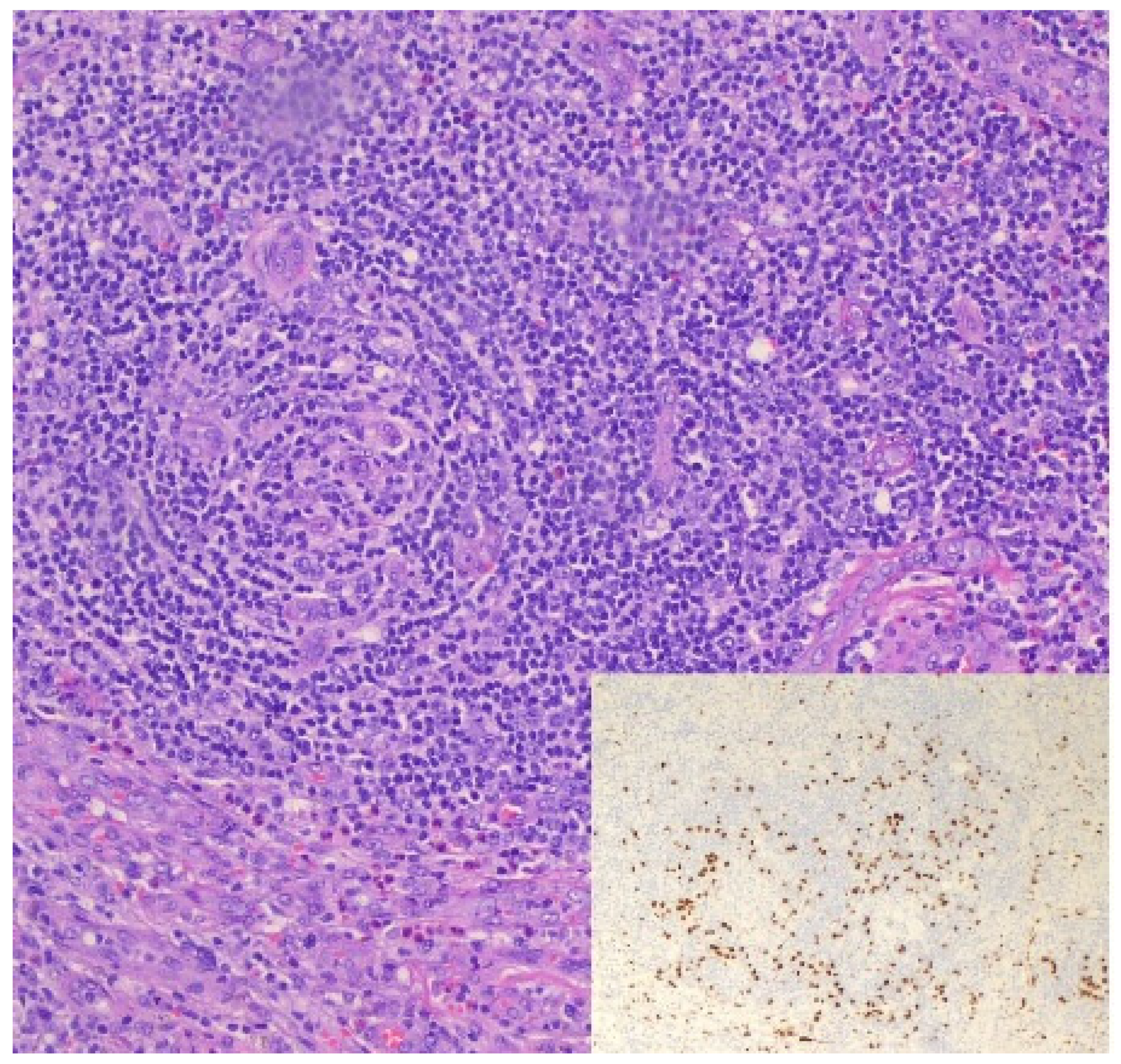 Lymphatics 03 00020 g004