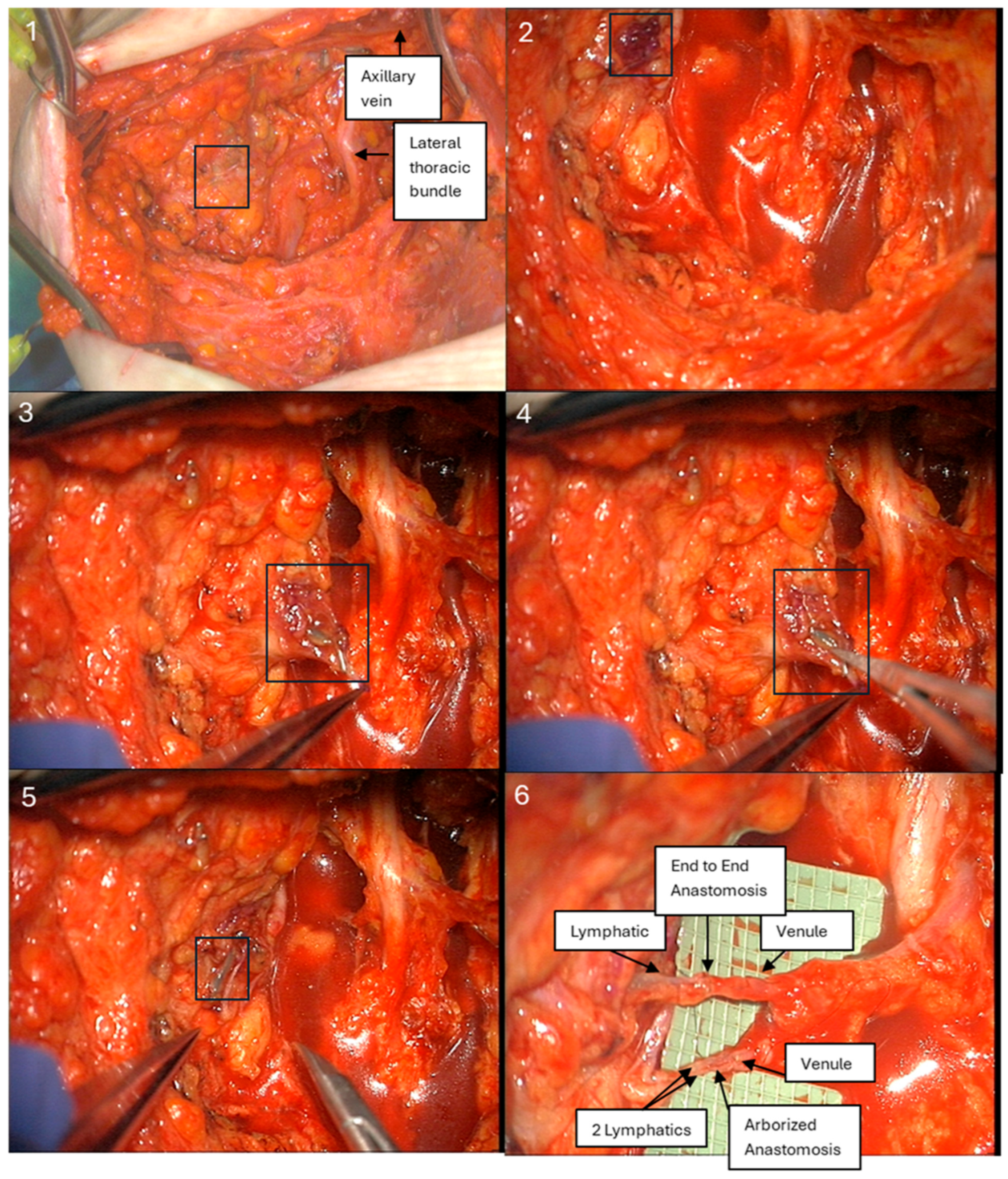 Lymphatics 03 00036 g001