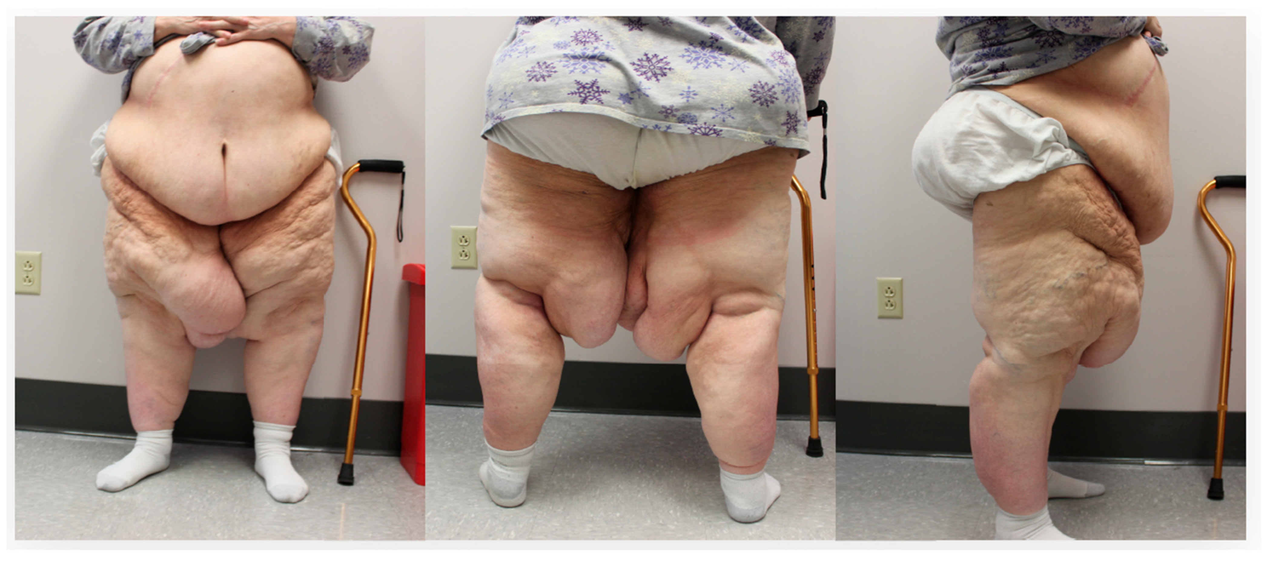 Lymphatics 03 00042 g002