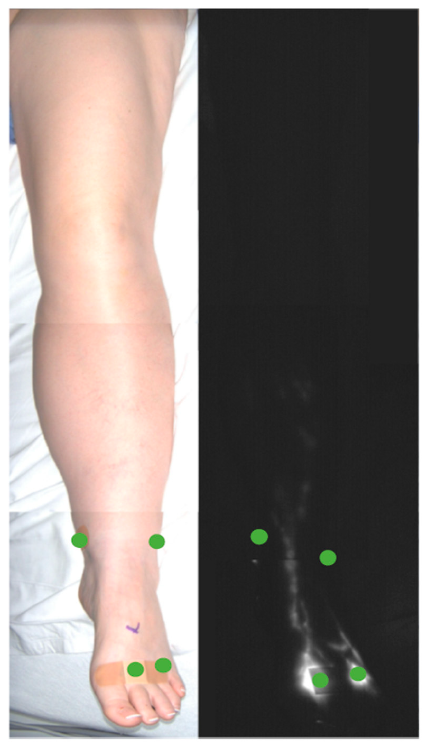 Lymphatics 03 00042 g003