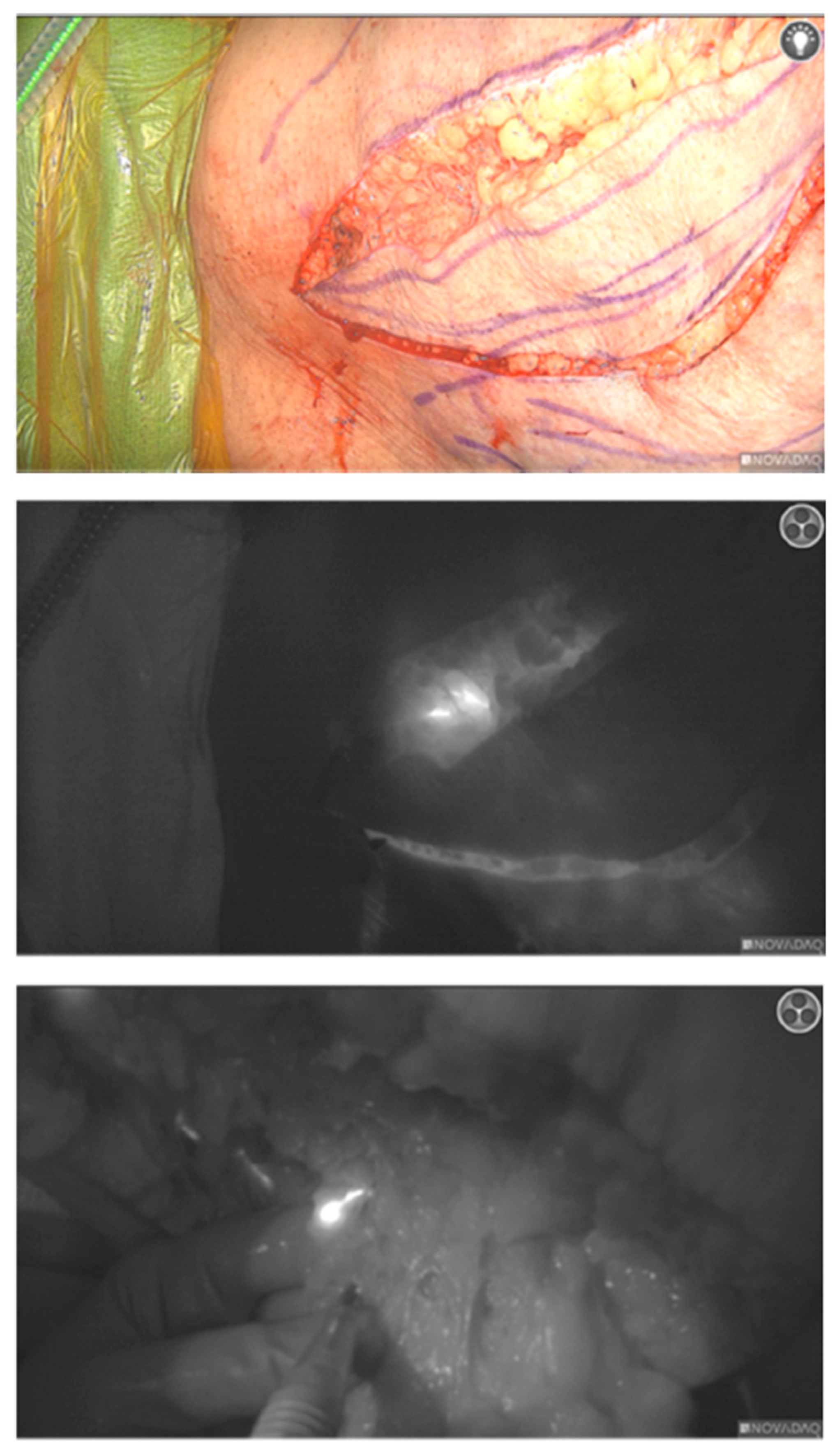 Lymphatics 03 00042 g004