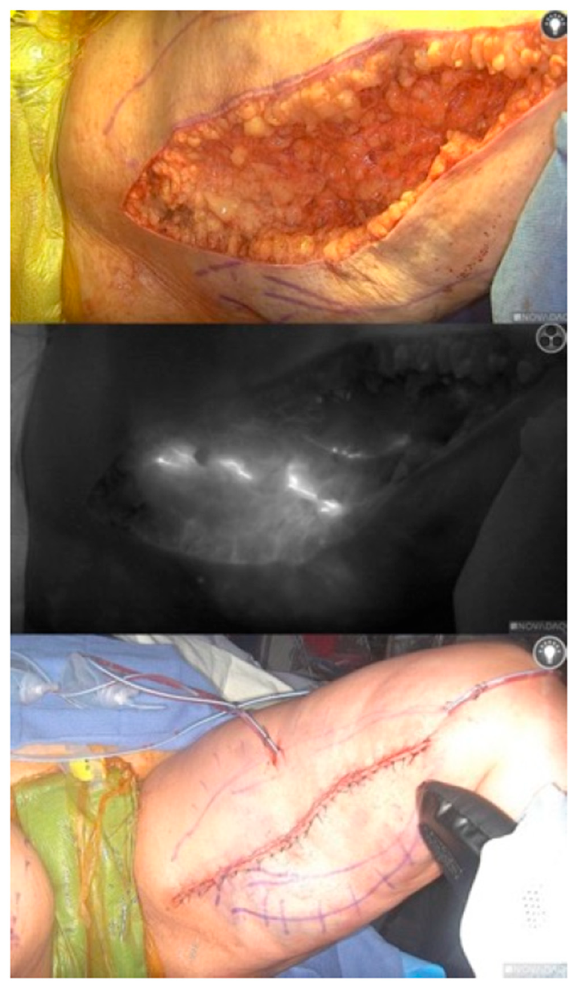 Lymphatics 03 00042 g005