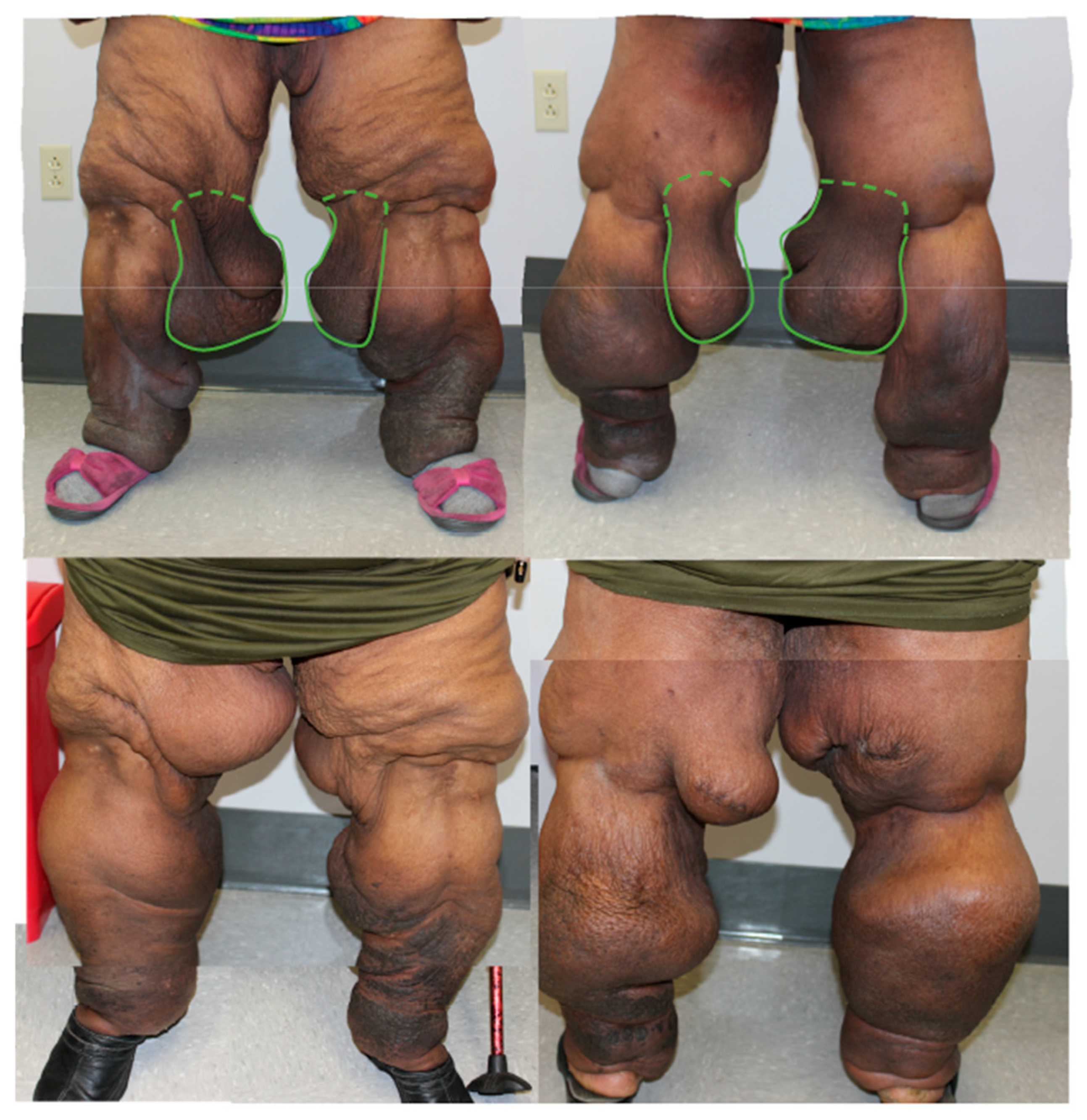 Lymphatics 03 00042 g006