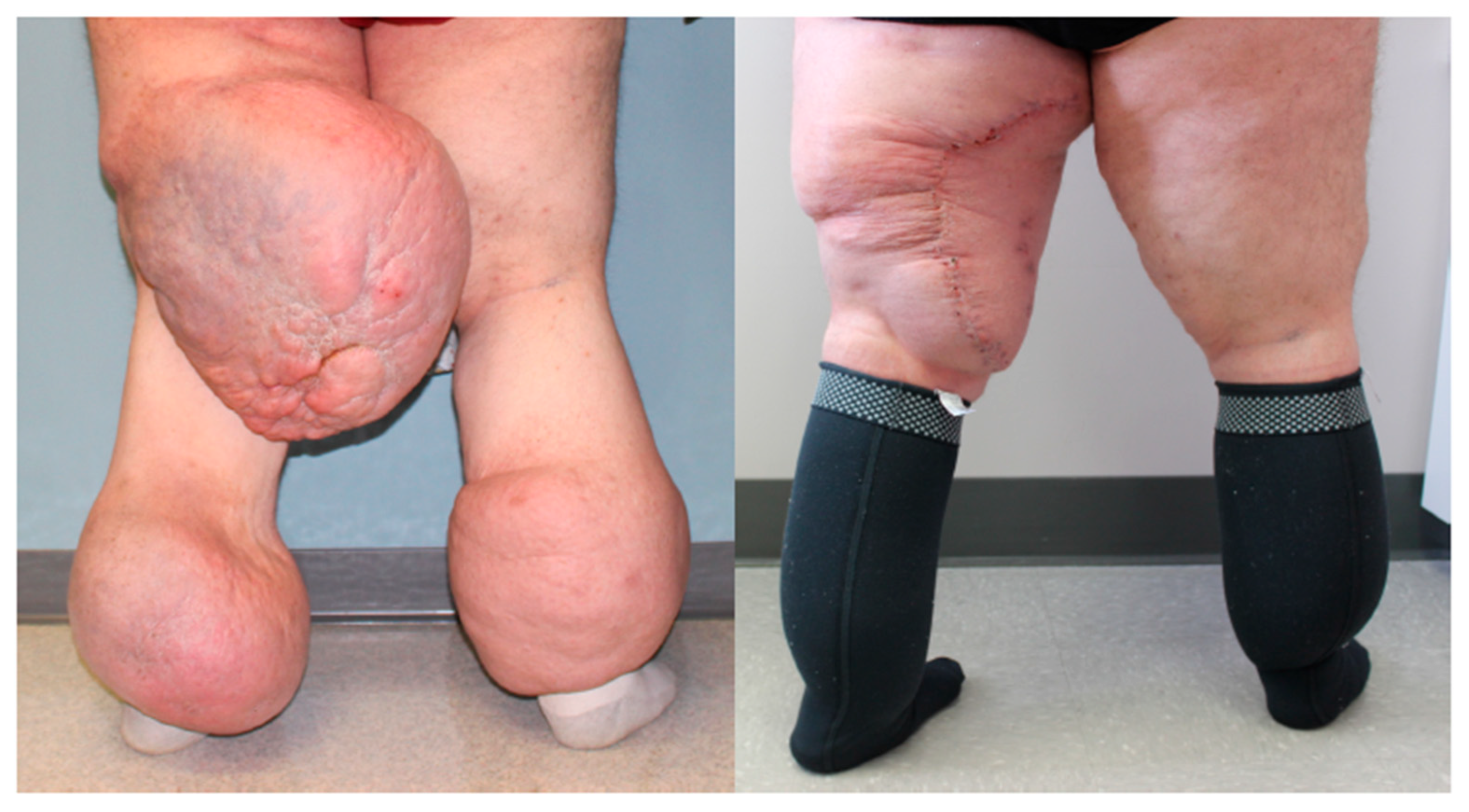 Lymphatics 03 00042 g007