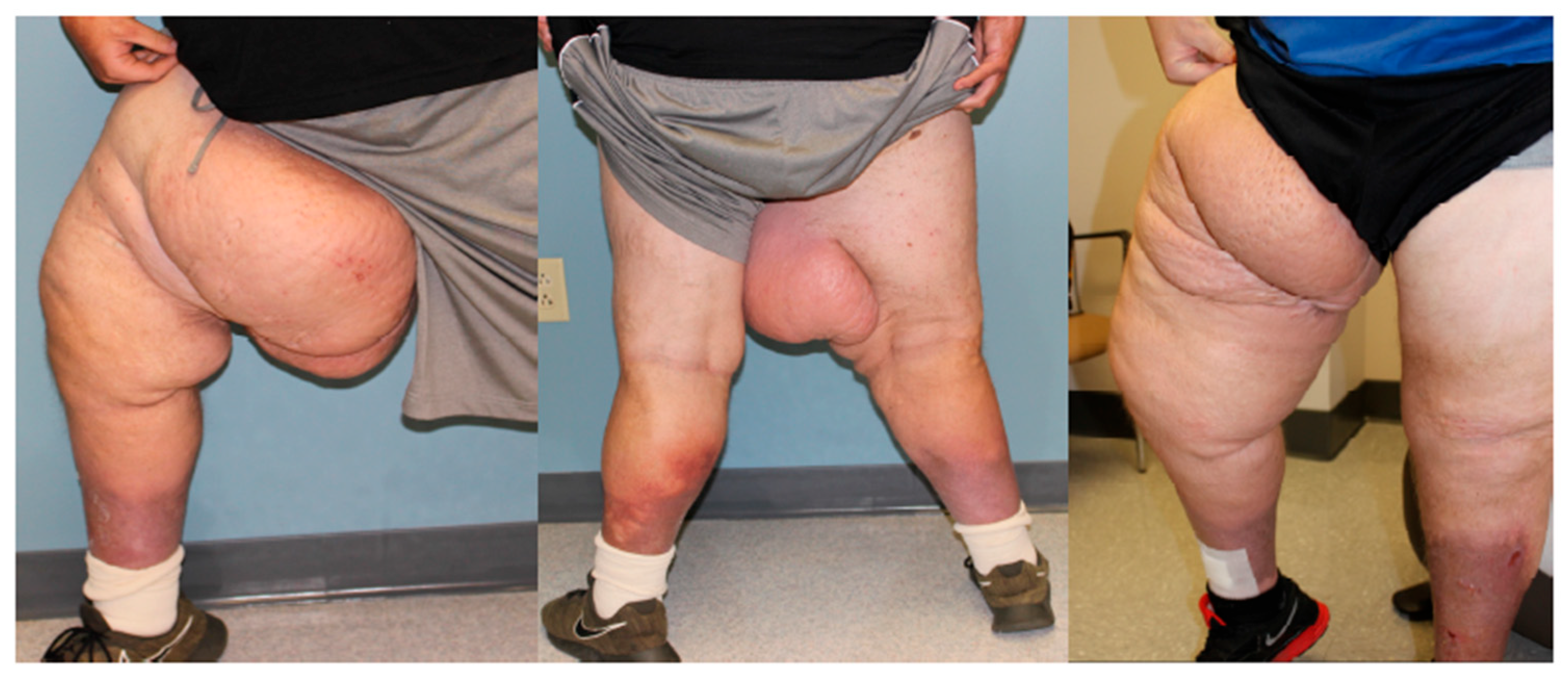 Lymphatics 03 00042 g008