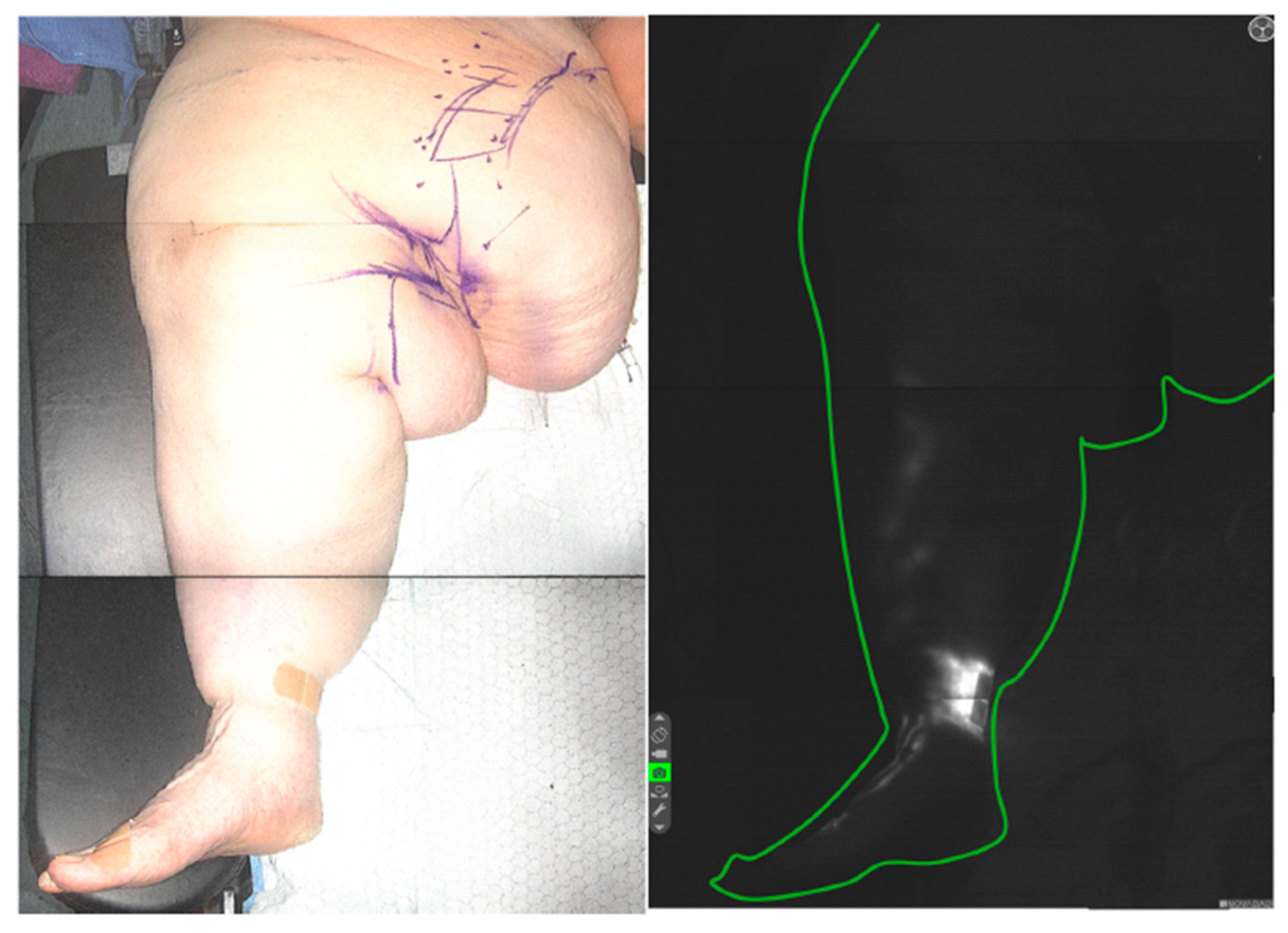 Lymphatics 03 00042 g009