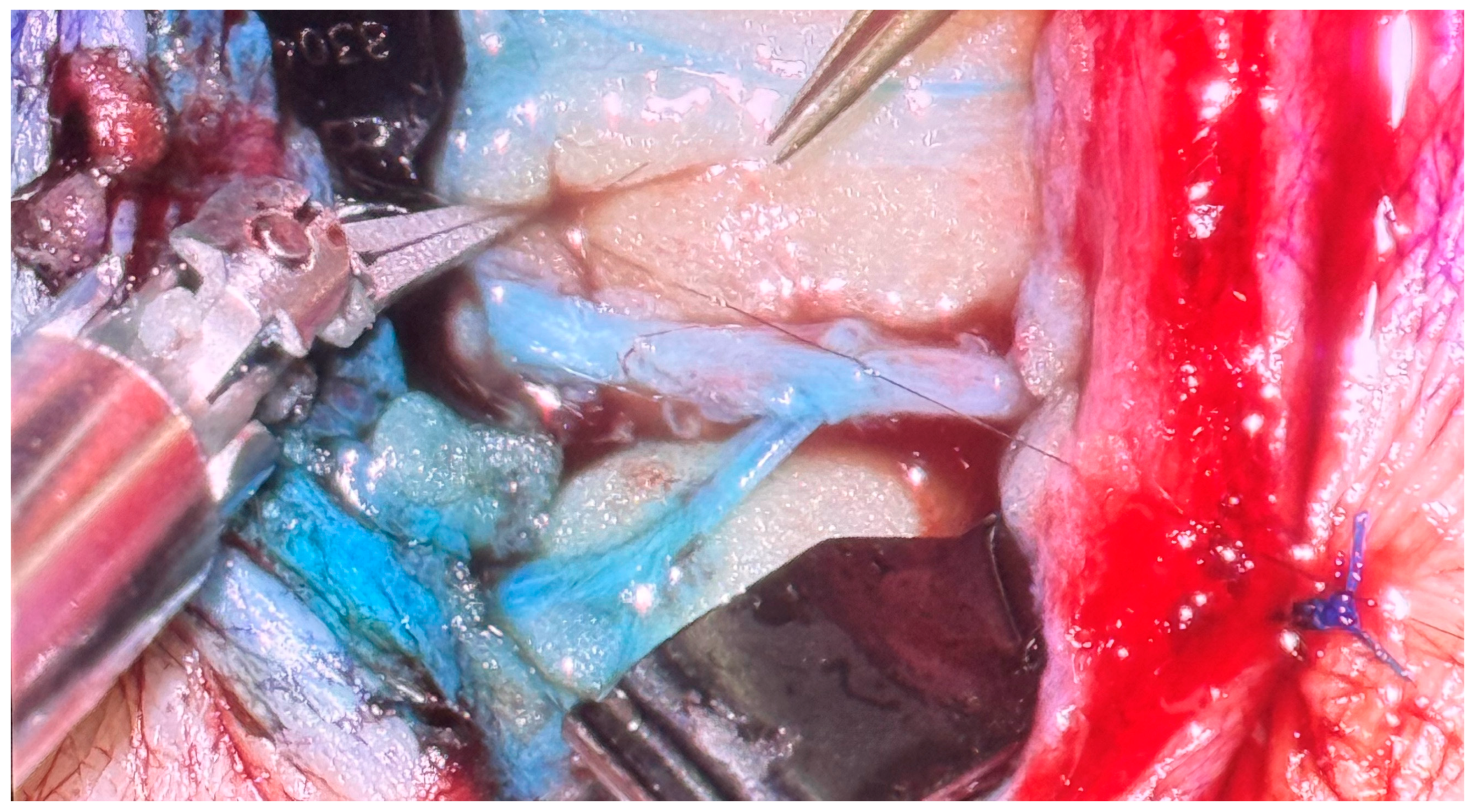 Lymphatics 04 00018 g002 Lymphatics 04 00018 g002