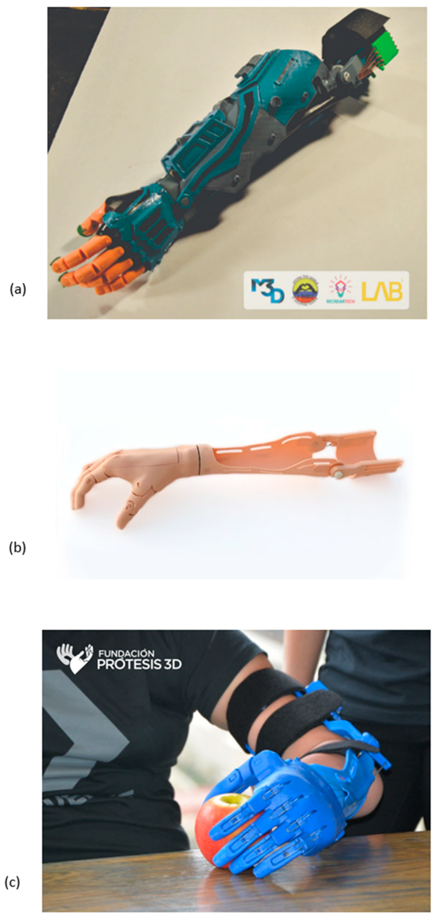 DIY Prosthetic Hand & Forearm (Voice Controlled) : 14 Steps (with Pictures)  - Instructables