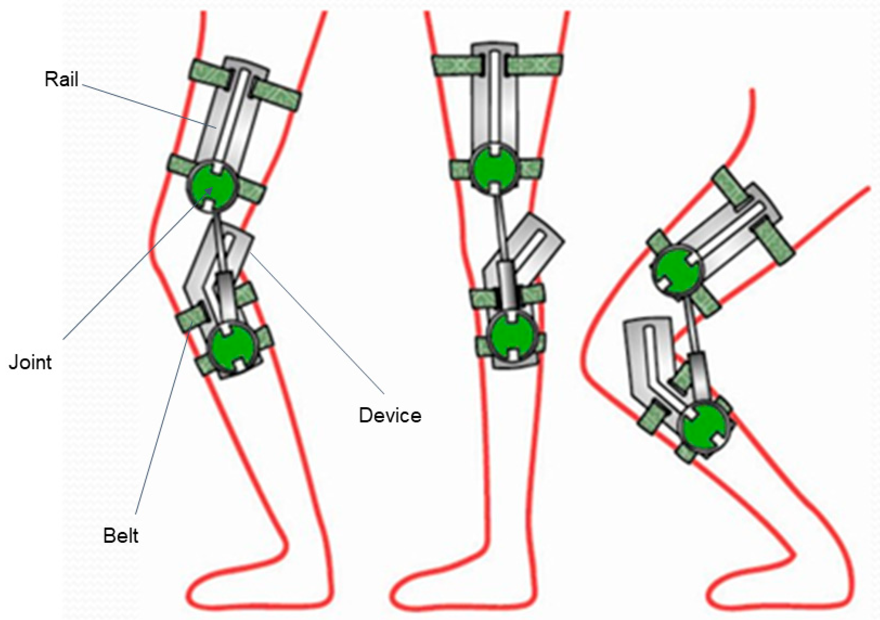 Support new device. Hybrid Assistive Limb structure. Hybrid Assistive Limb какой привод использован. Hybrid Assistive Limb Servos. Hybrid Assistive Limb drawings.