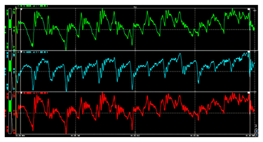 Machines 13 00117 i002