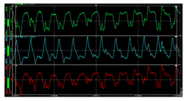 Machines 13 00117 i003