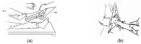 Modified Dynamic Movement Primitive-Based Closed Ankle