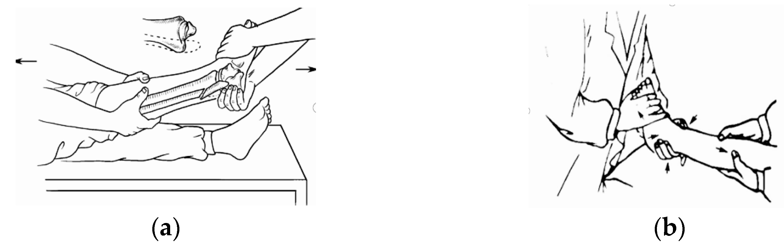 Machines 13 00145 g003