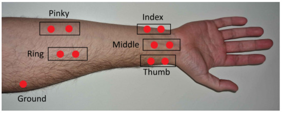 Lectroids Hand Myoelectric Controlled Bionic Robotic Hand for Voluntary Finger Motion ...