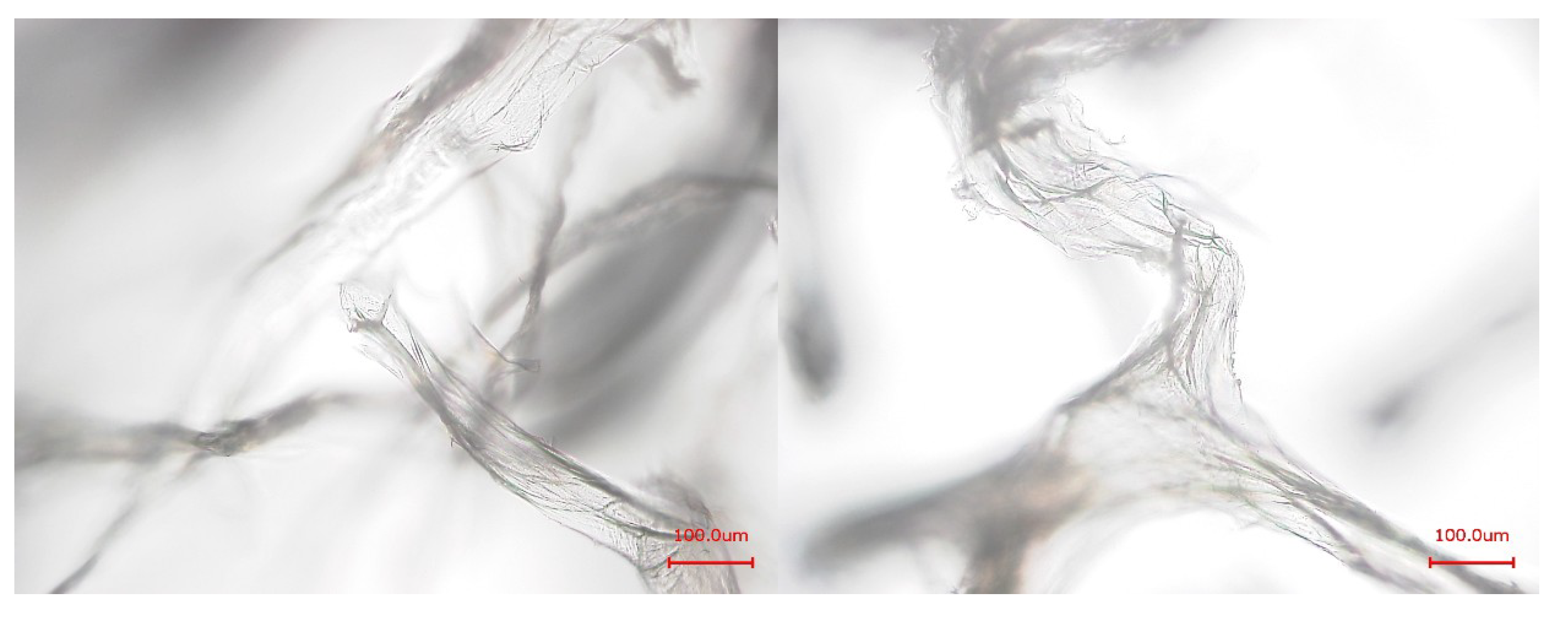 Marinedrugs 12 04417 g003 1024