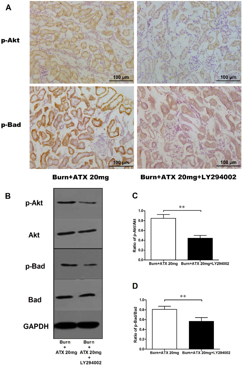 Marine Drugs Free FullText Astaxanthin Attenuates Early Acute