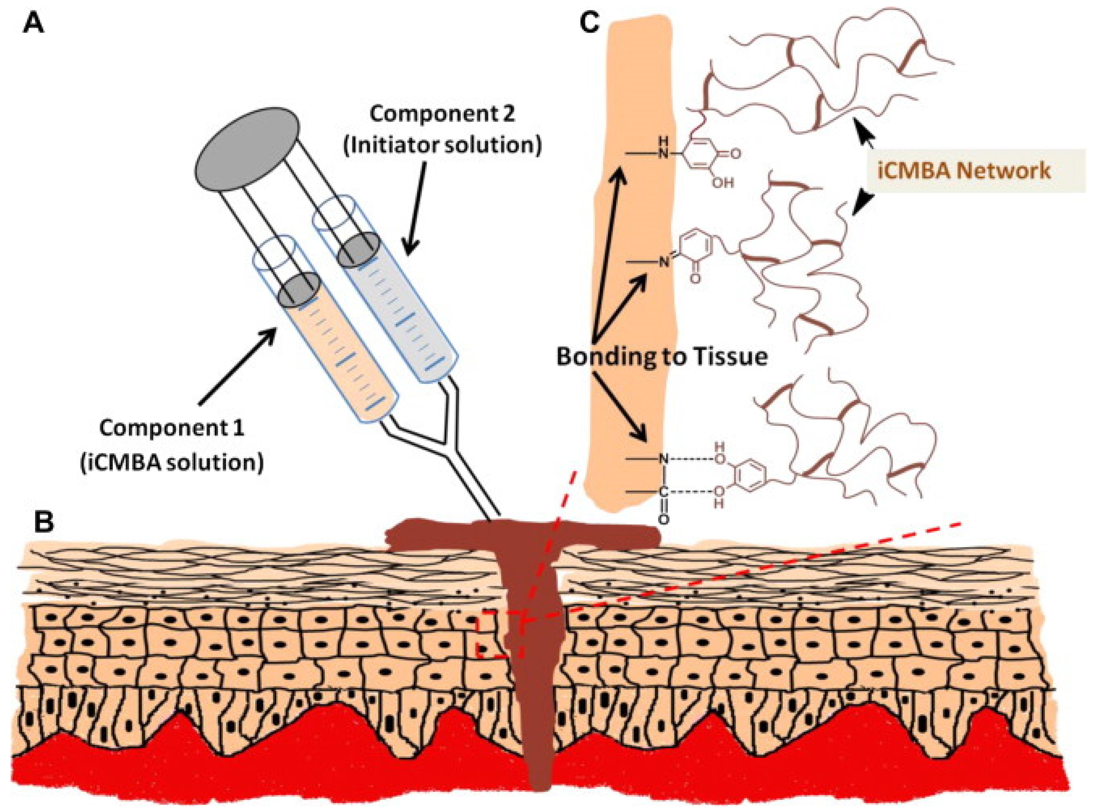 New mussel-inspired surgical protein glue: Close wounds, open medical  possibilities