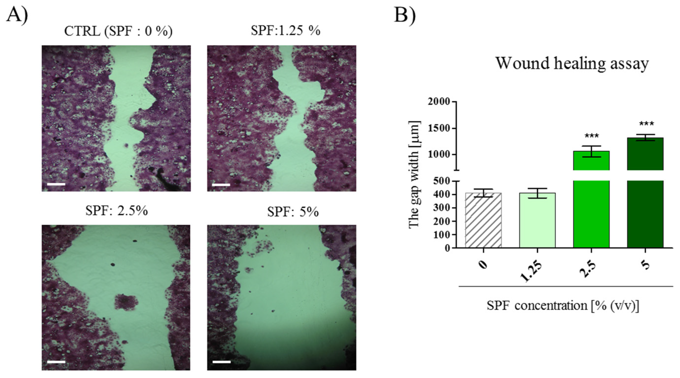 Marinedrugs 15 00065 g002a 550